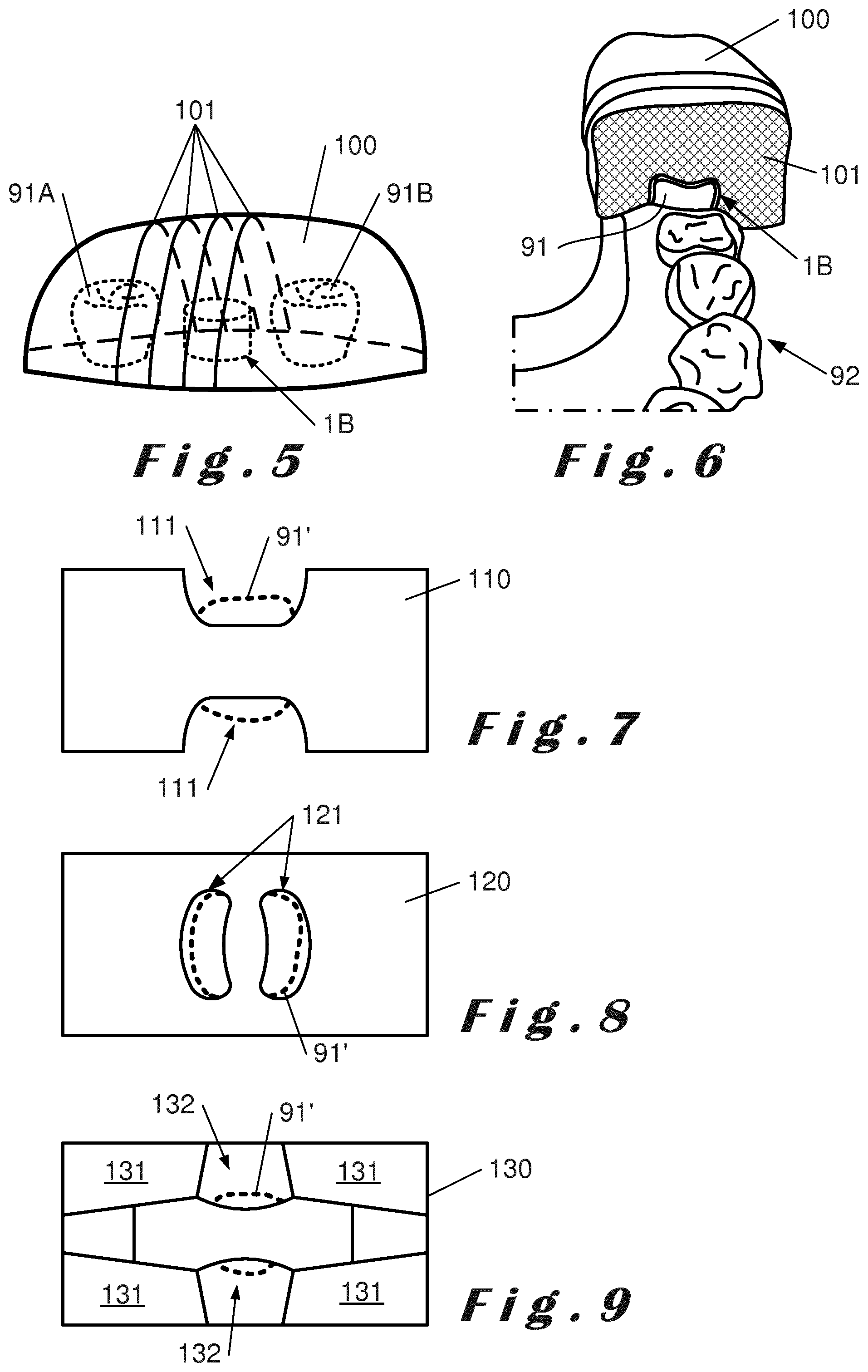 Patent US12396830 Figure 5 – Method for designing a prosthetic element
