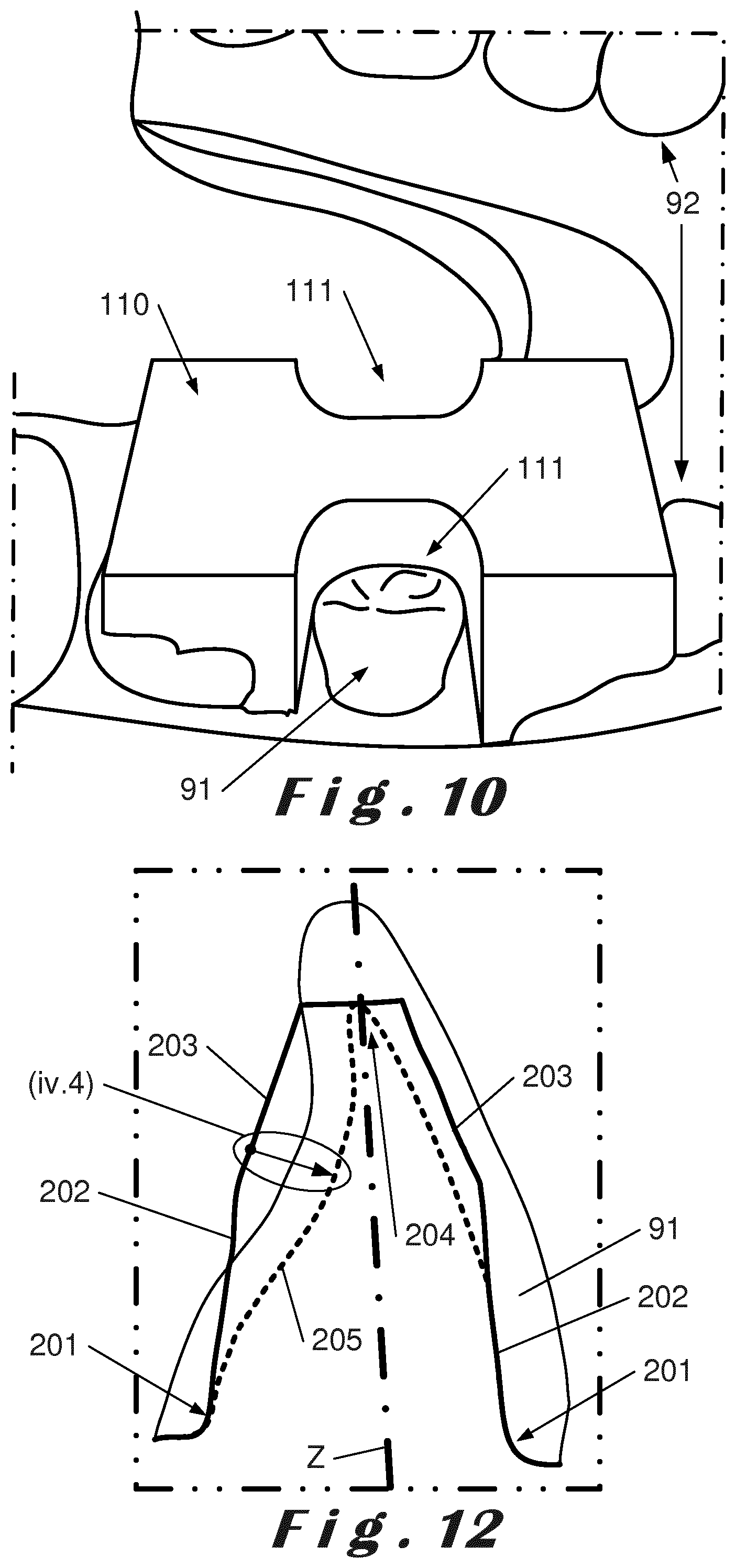 Patent US12396830 Figure 6 – Method for designing a prosthetic element
