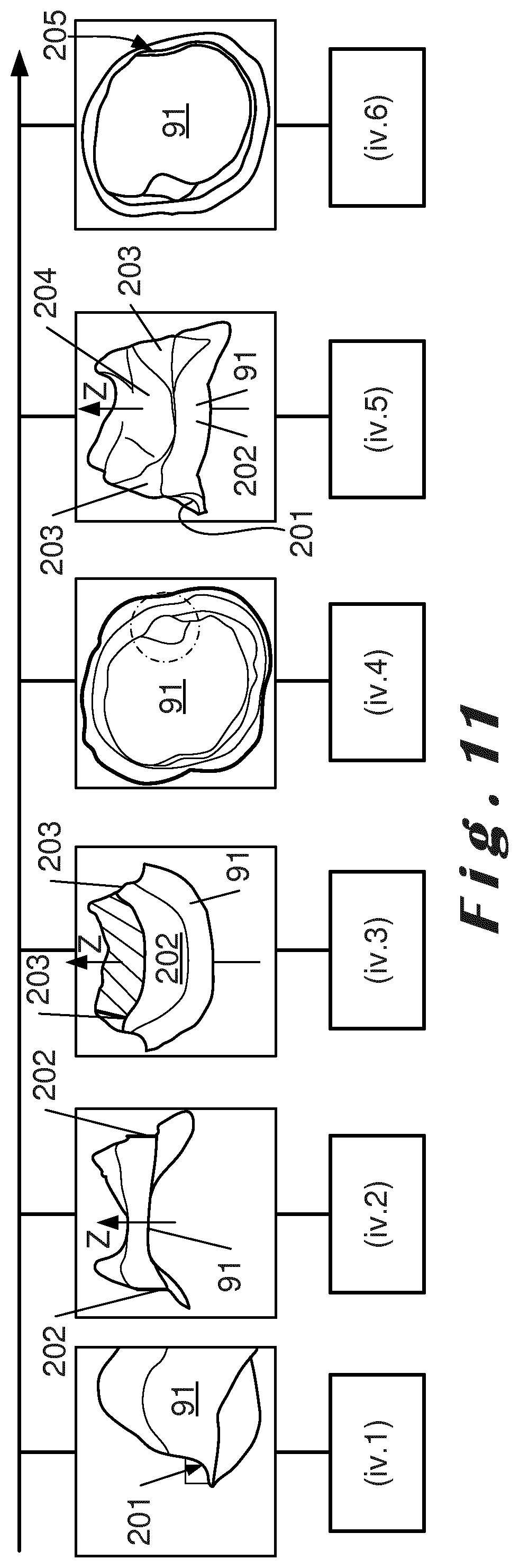 Patent US12396830 Figure 7 – Method for designing a prosthetic element