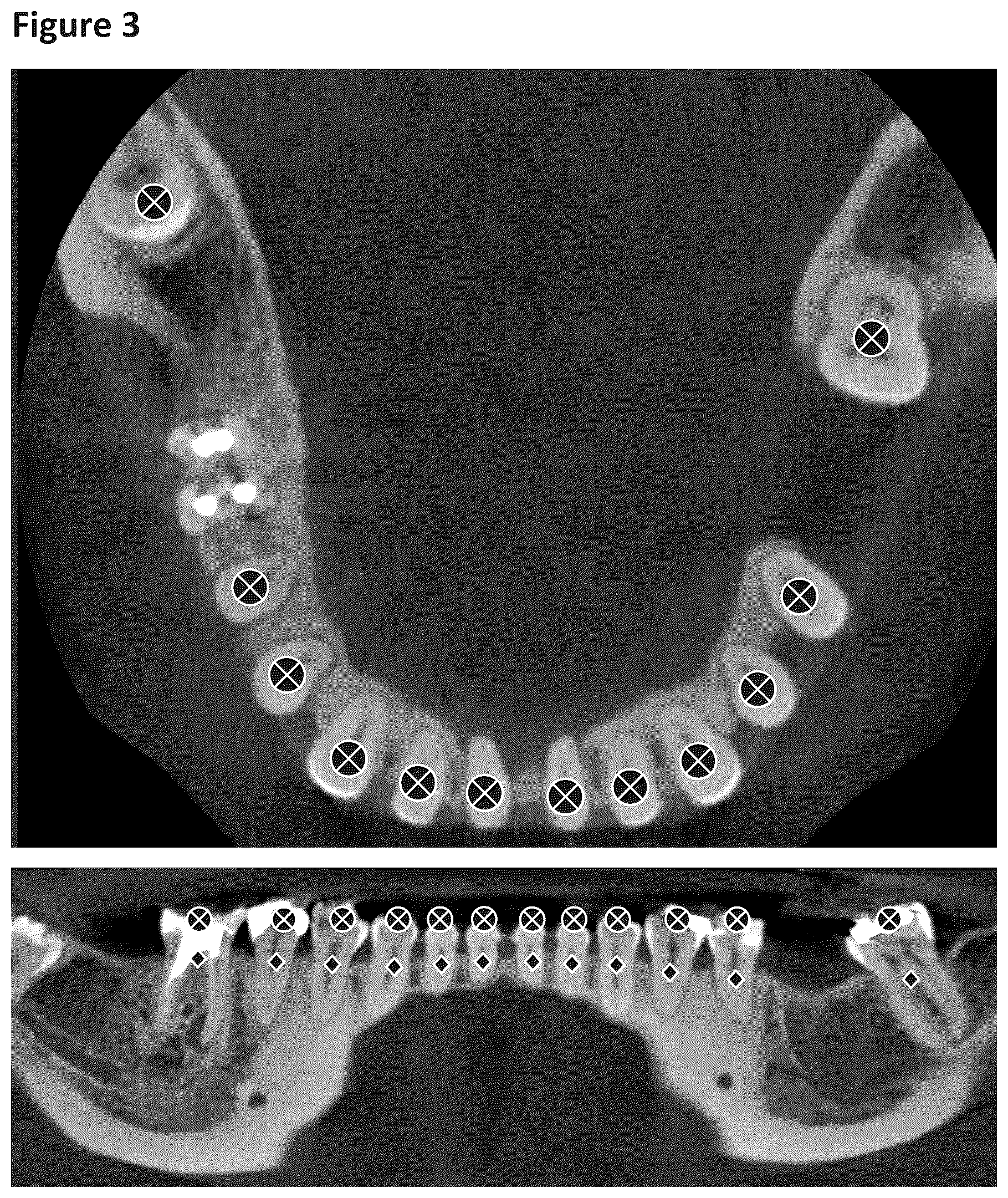 Patent US12396831 Figure 2 – Manufacturing of orthodontic devices based on standardized scan representations