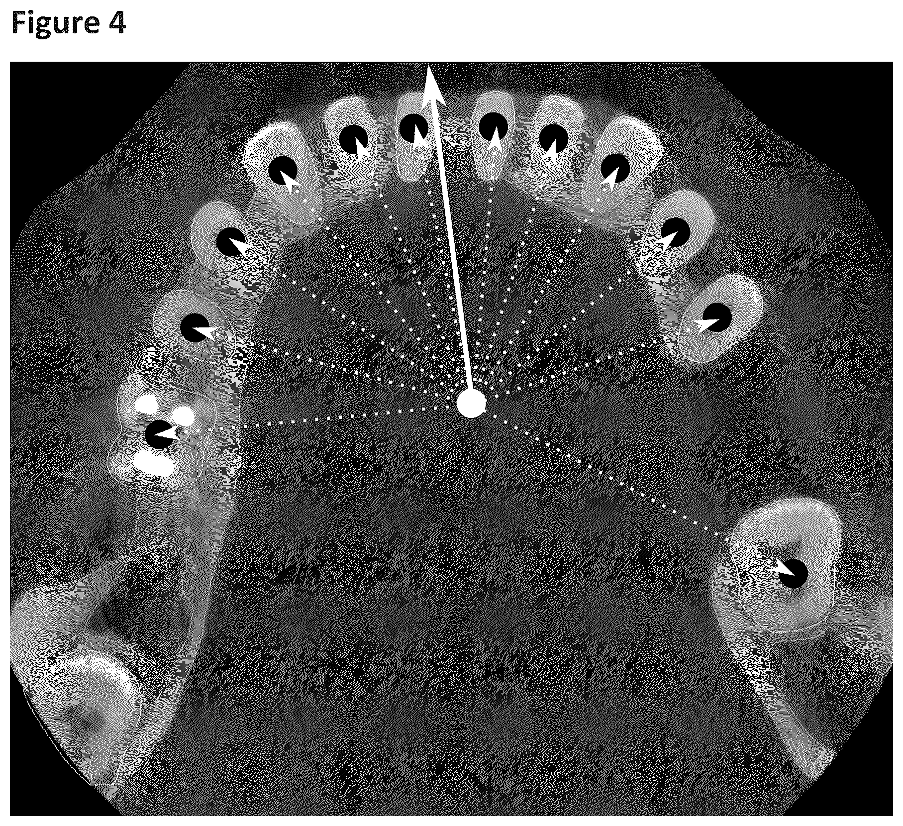 Patent US12396831 Figure 3 – Manufacturing of orthodontic devices based on standardized scan representations