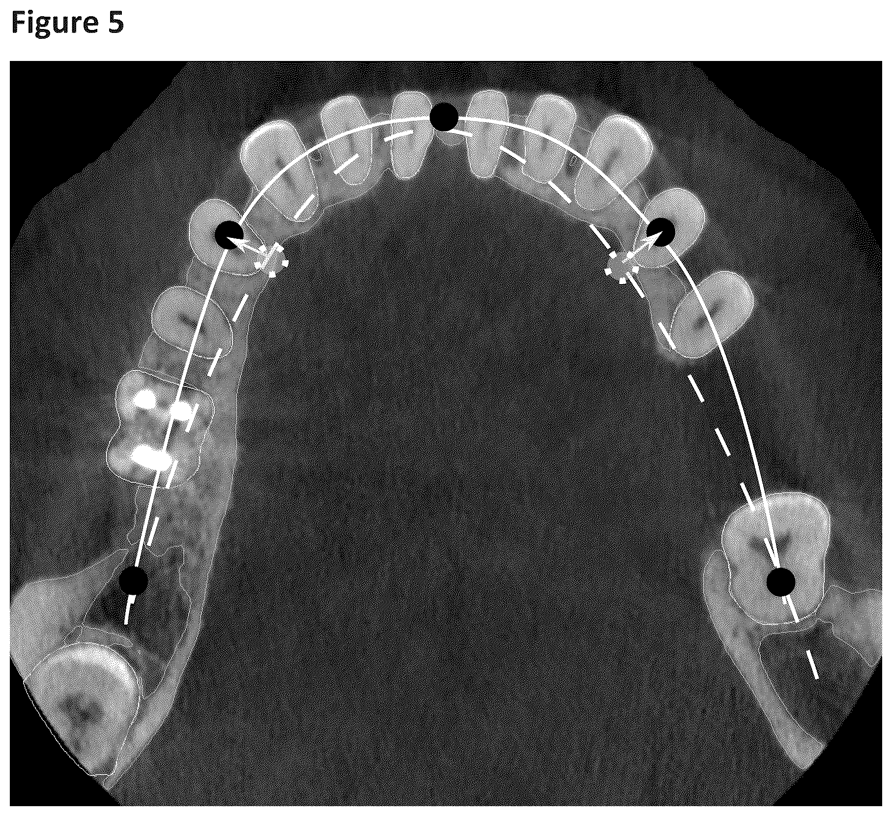 Patent US12396831 Figure 4 – Manufacturing of orthodontic devices based on standardized scan representations