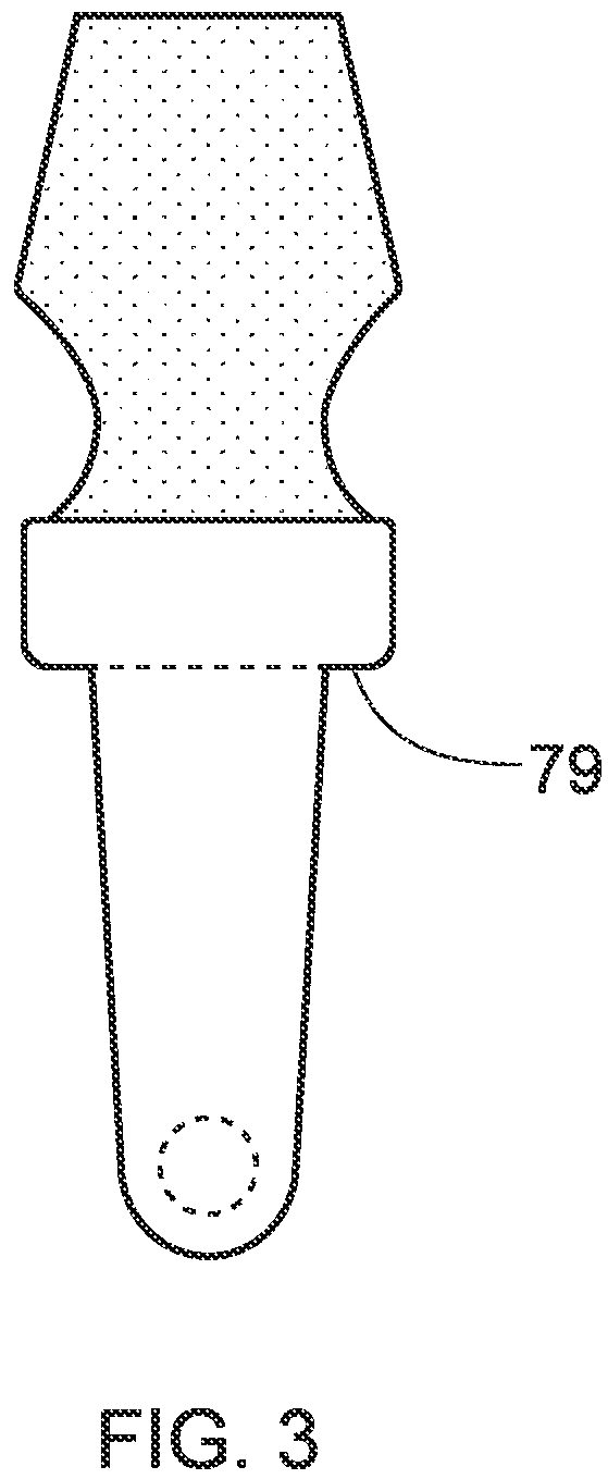 Patent US12396832 Figure 3 – Implant