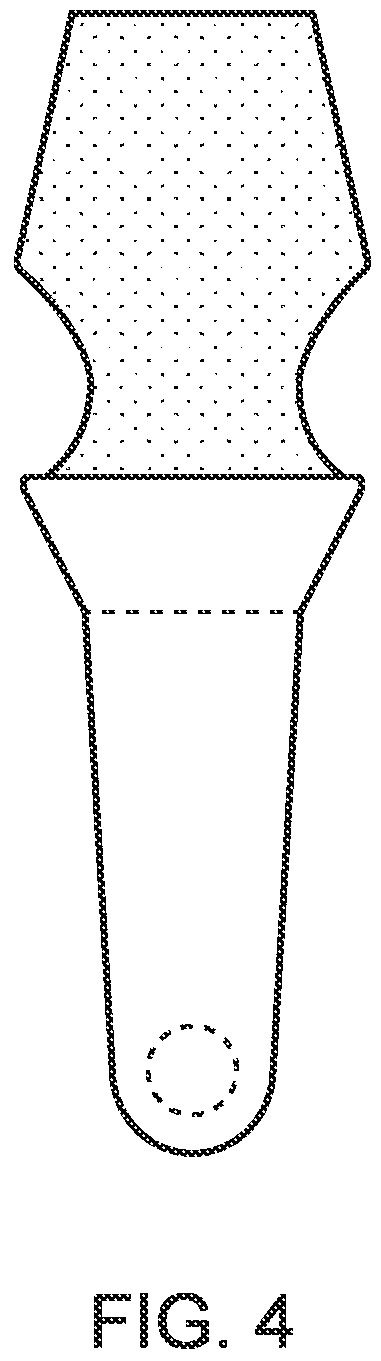 Patent US12396832 Figure 4 – Implant