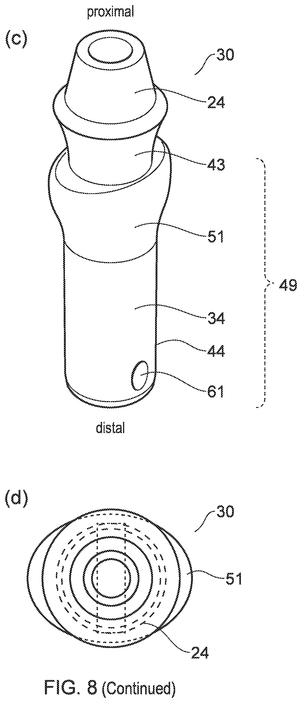 Patent US12396832 Figure 9 – Implant