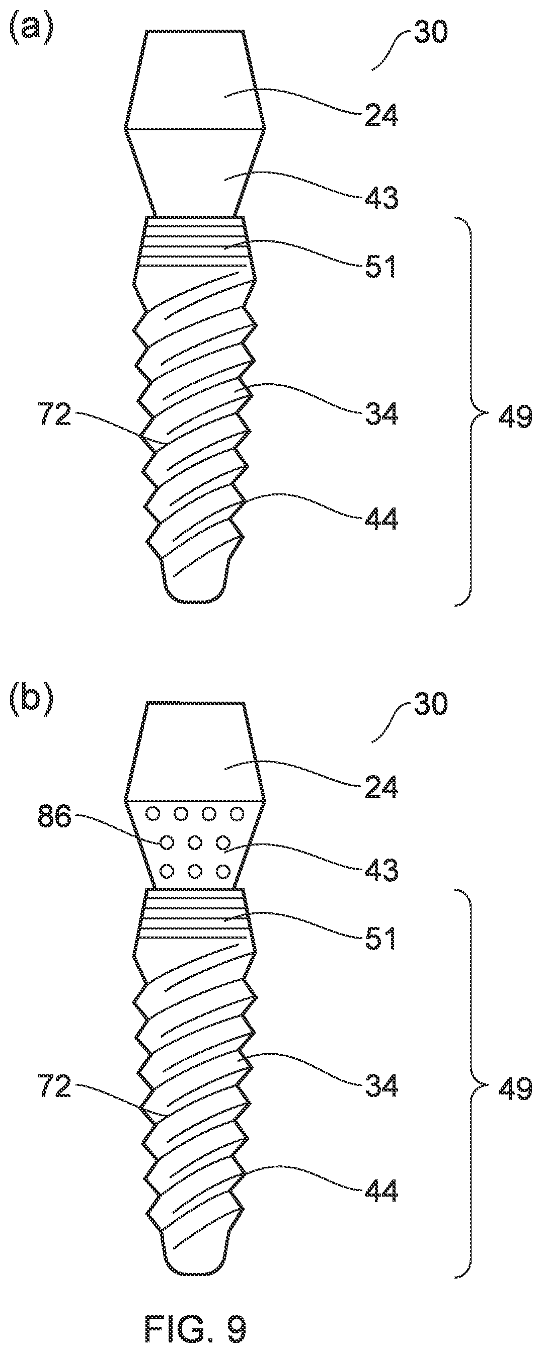 Patent US12396832 Figure 10 – Implant