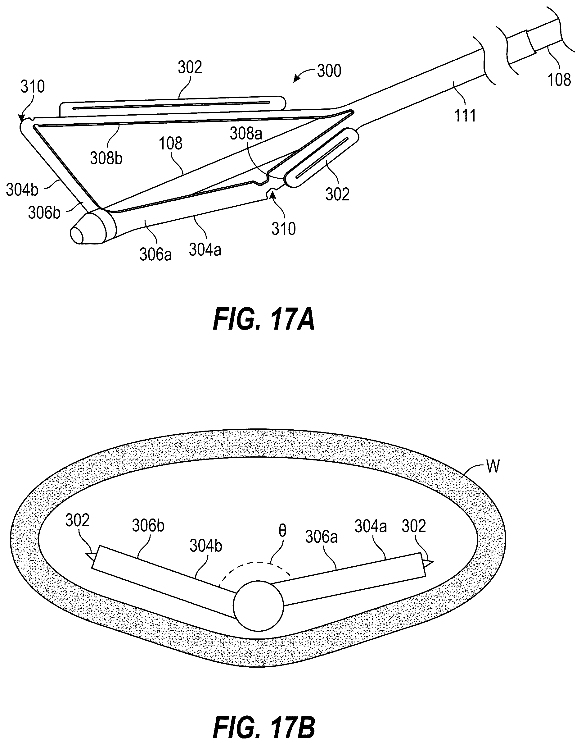 Patent US12396835 Figure 13 – Interventional systems and associated devices and methods