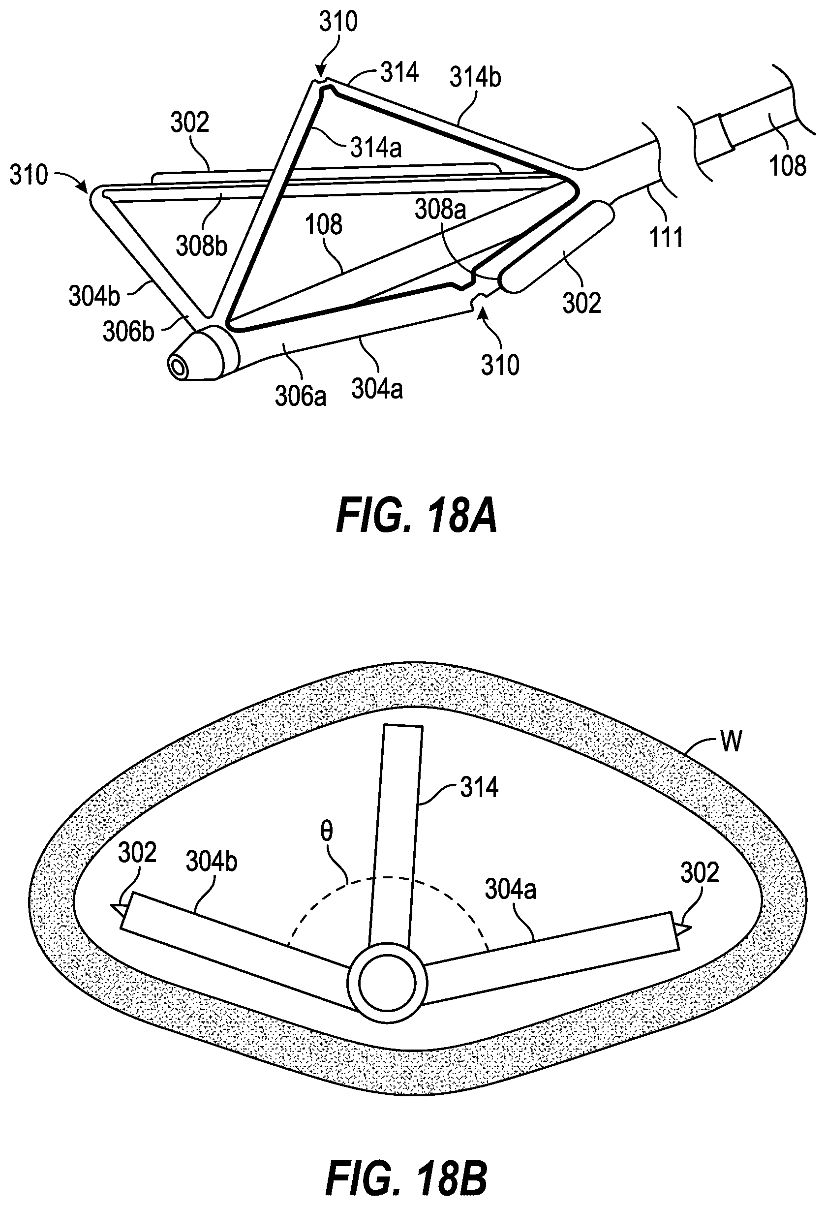 Patent US12396835 Figure 14 – Interventional systems and associated devices and methods