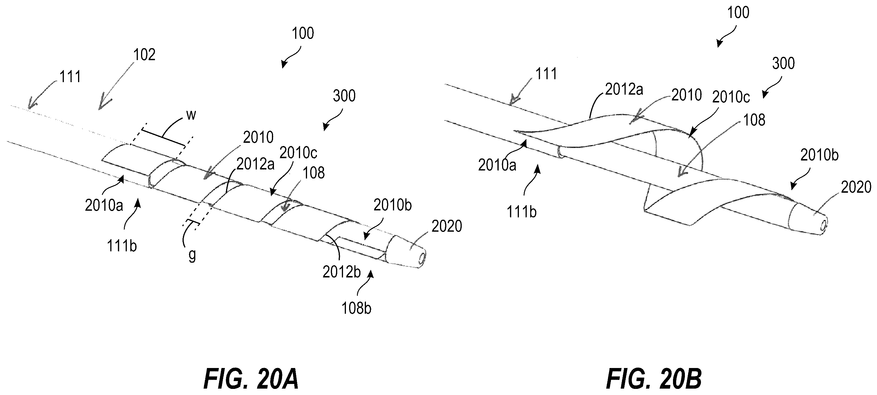 Patent US12396835 Figure 17 – Interventional systems and associated devices and methods