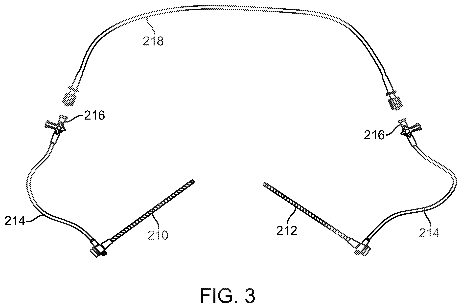 Patent US12396836 Figure 9 – Fenestrated sheath for embolic protection during transcarotid carotid artery revascularization