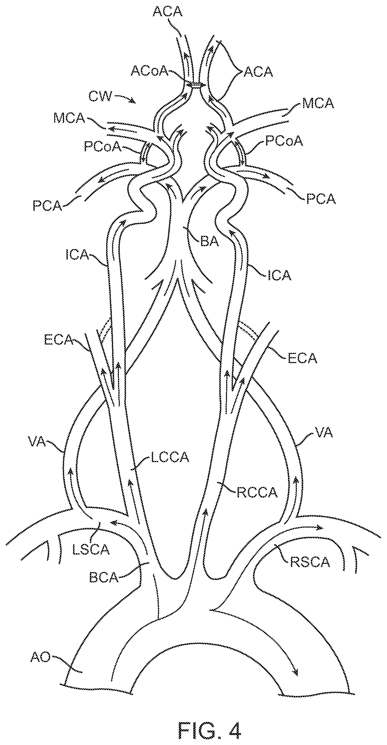 Patent US12396836 Figure 10 – Fenestrated sheath for embolic protection during transcarotid carotid artery revascularization
