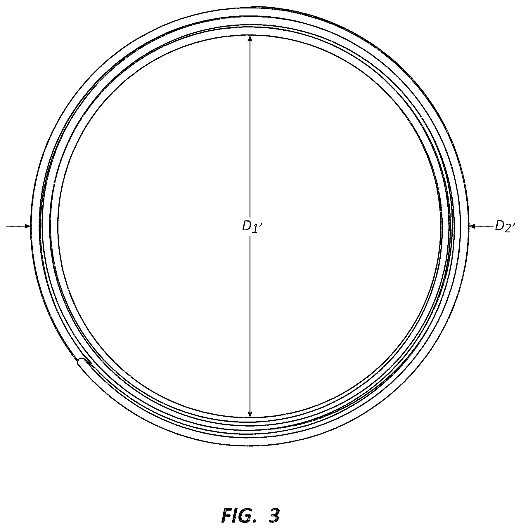 Patent US12396837 Figure 2 – Electrospun PTFE coated stent and method of use