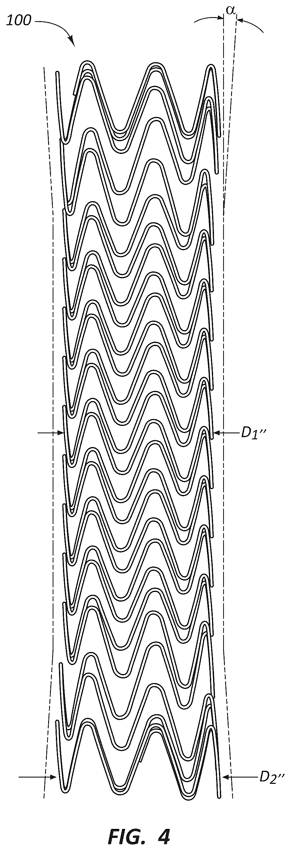 Patent US12396837 Figure 3 – Electrospun PTFE coated stent and method of use