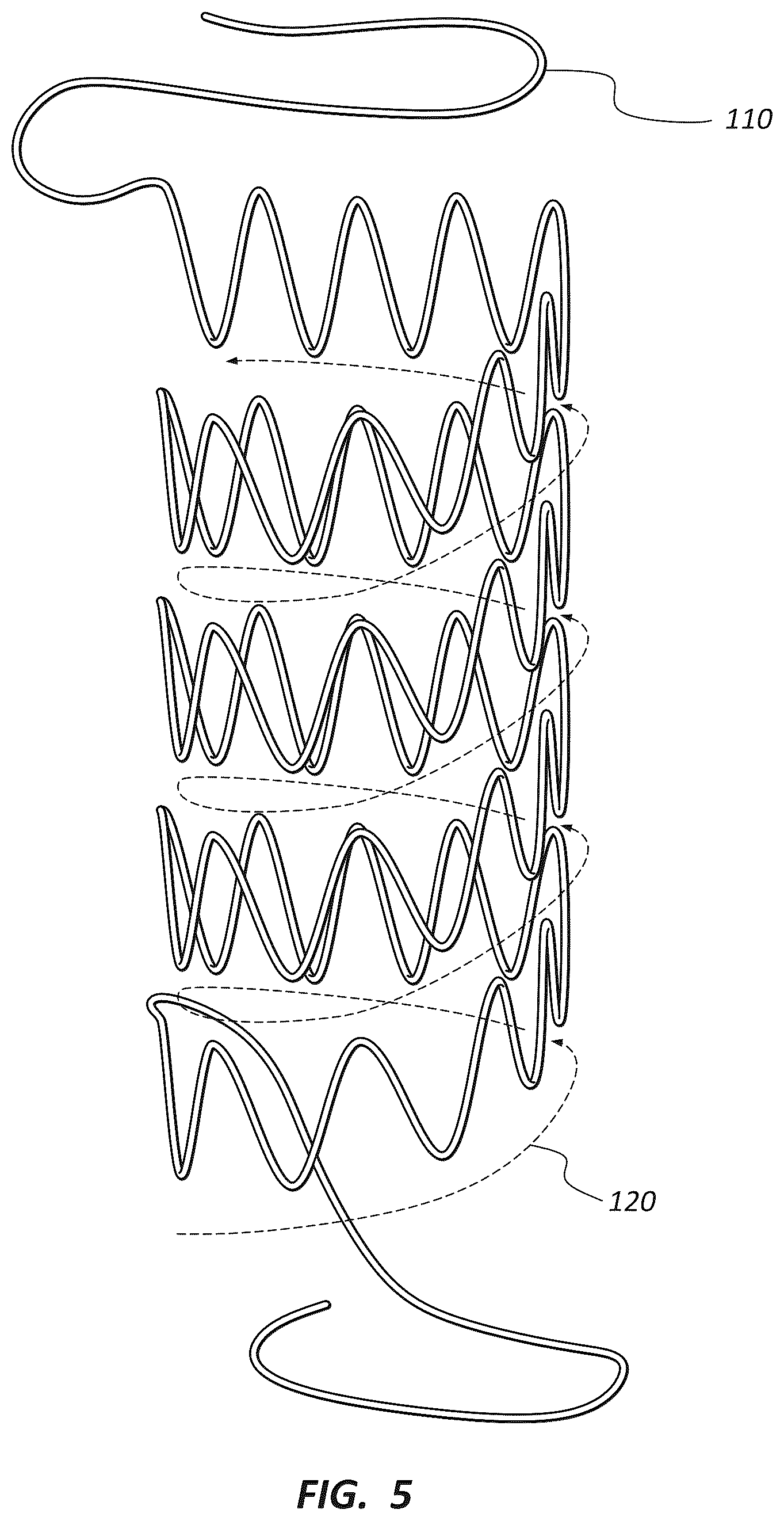 Patent US12396837 Figure 4 – Electrospun PTFE coated stent and method of use