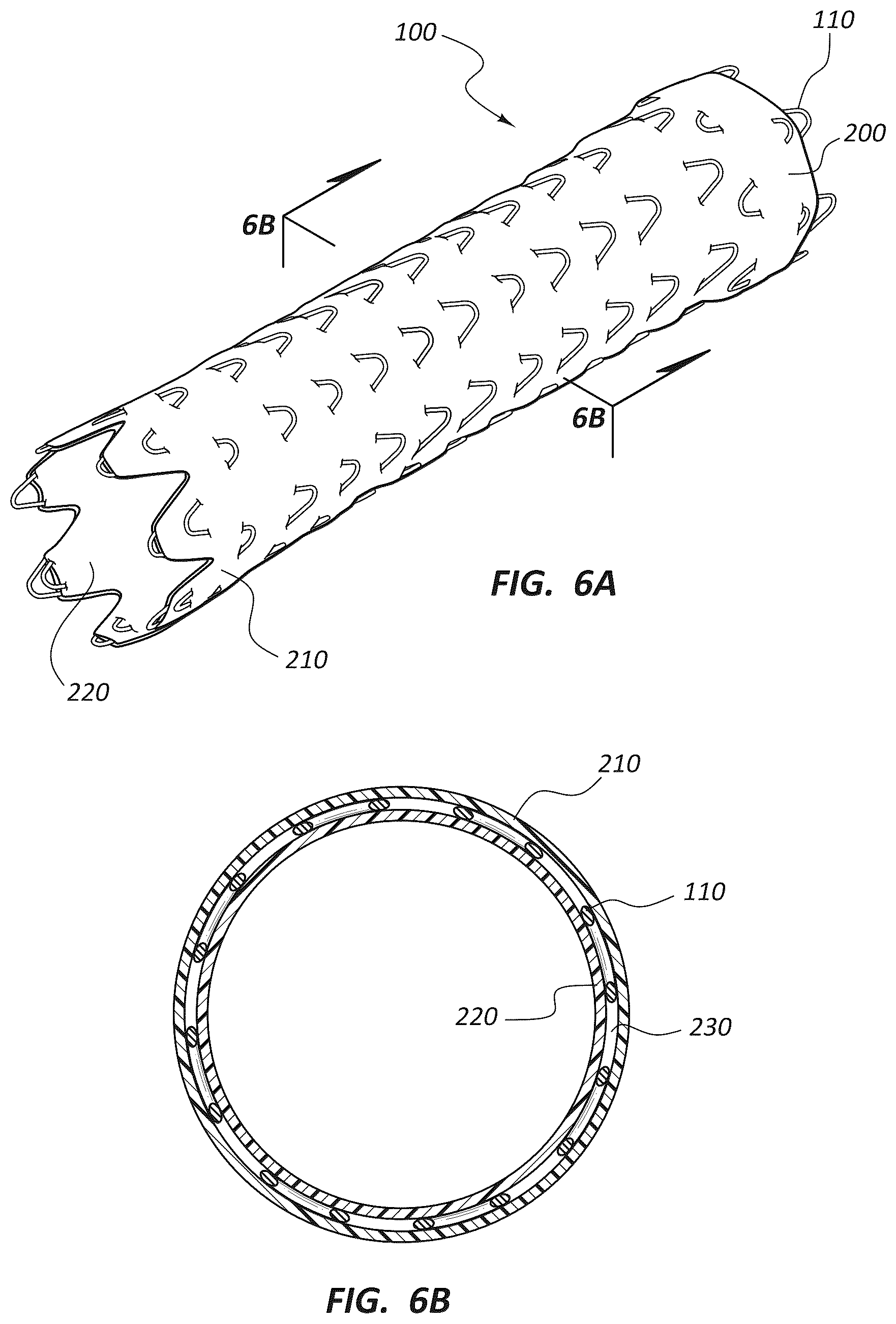 Patent US12396837 Figure 5 – Electrospun PTFE coated stent and method of use