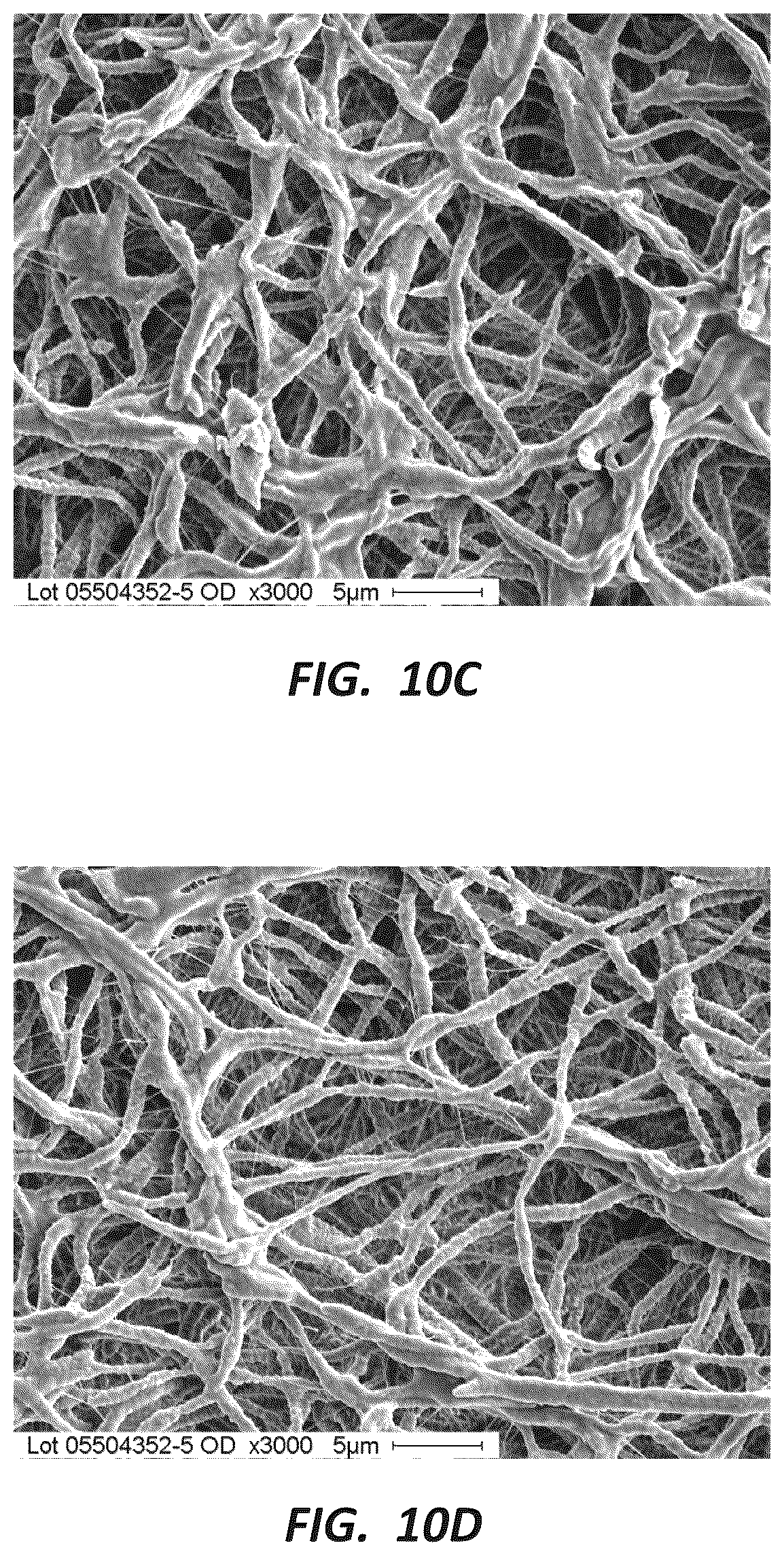 Patent US12396837 Figure 12 – Electrospun PTFE coated stent and method of use
