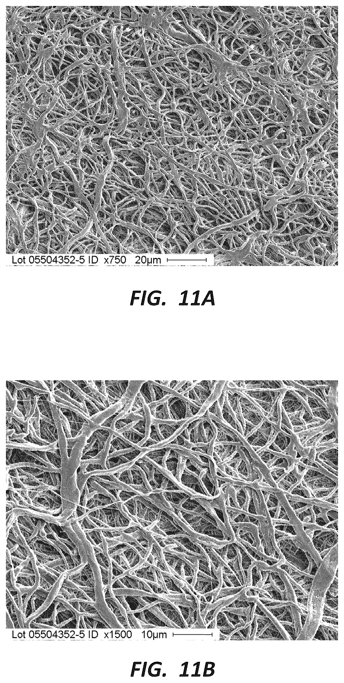 Patent US12396837 Figure 13 – Electrospun PTFE coated stent and method of use