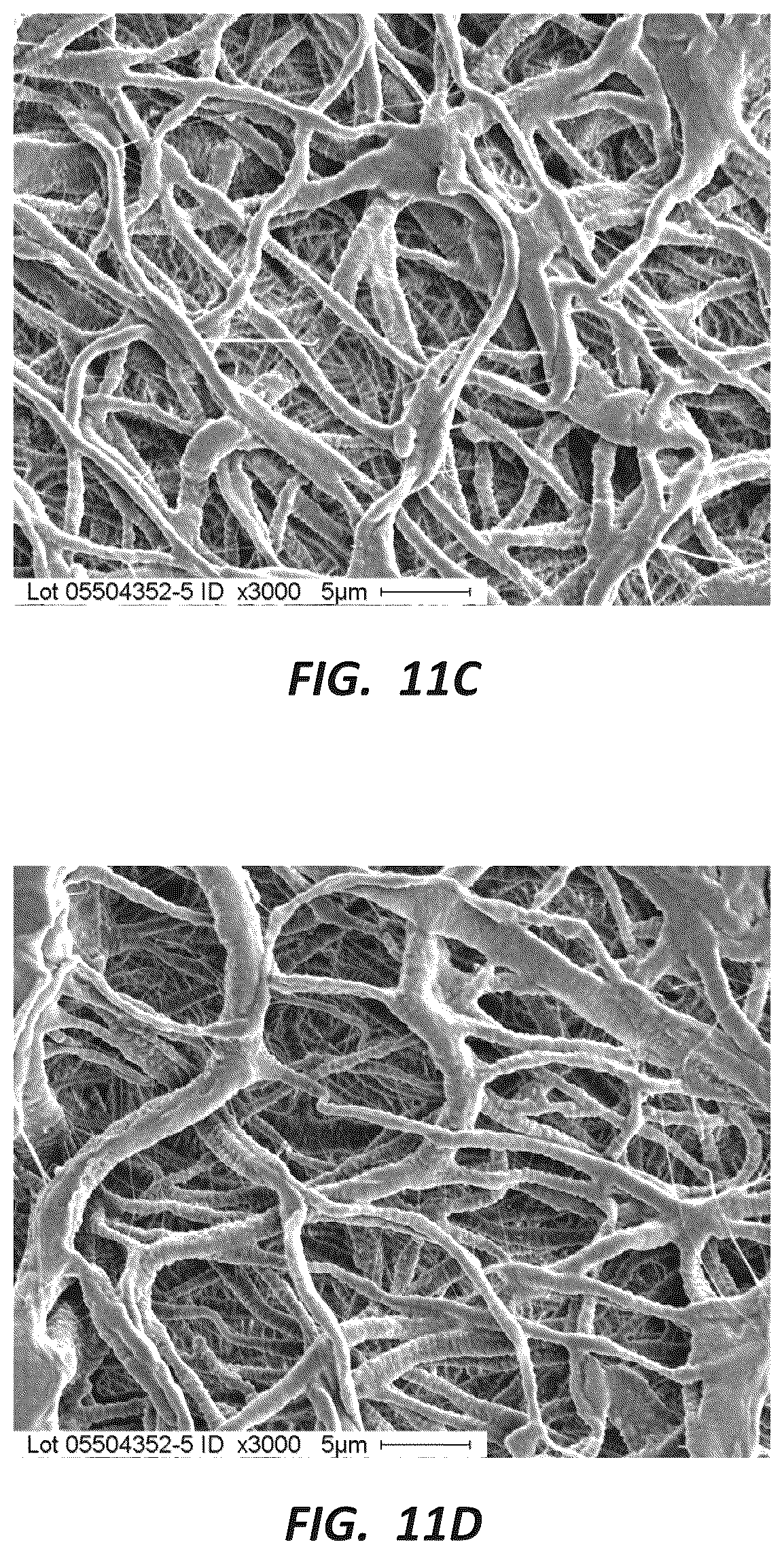 Patent US12396837 Figure 14 – Electrospun PTFE coated stent and method of use