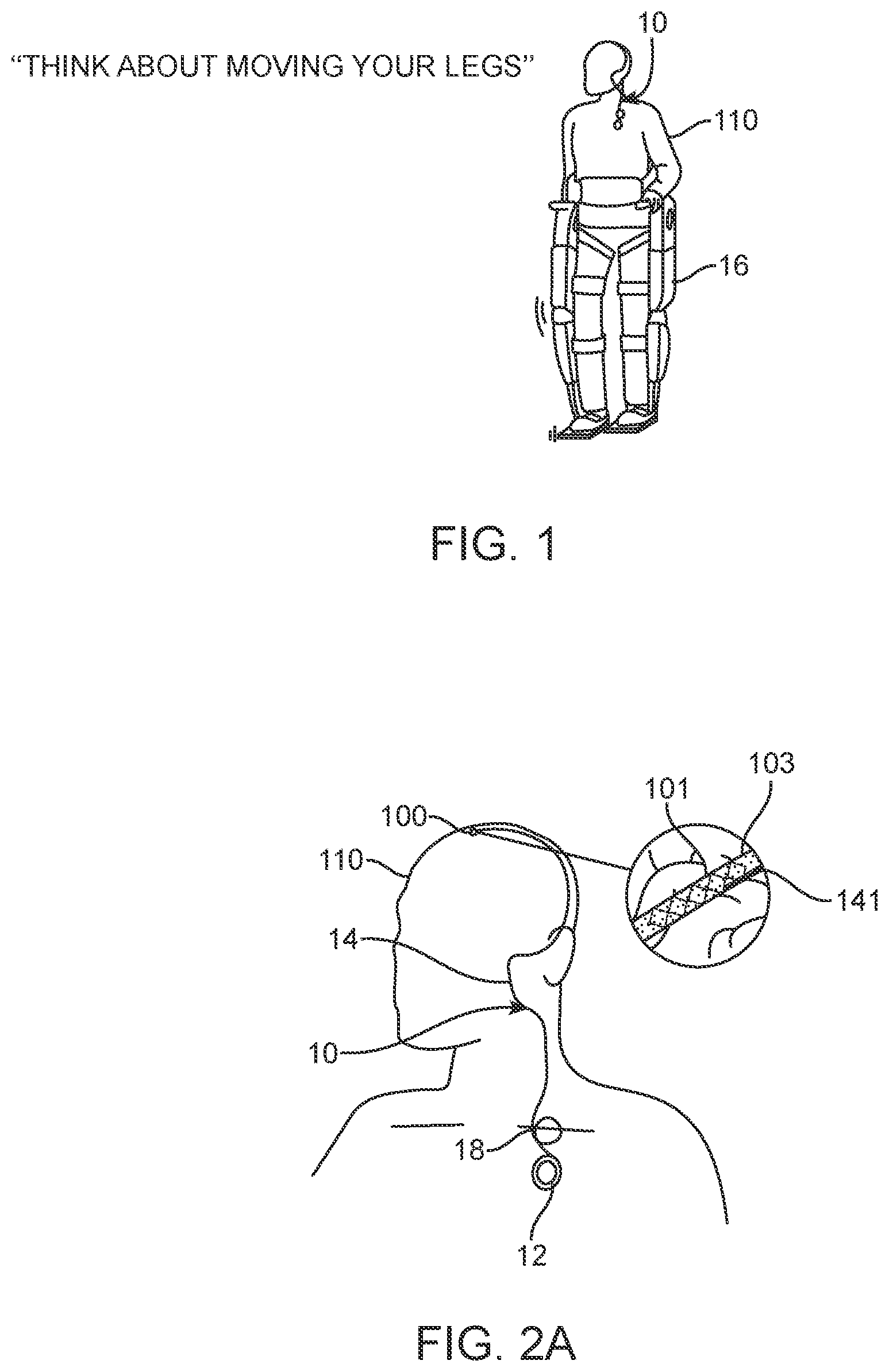 Patent US12396838 Figure 1 – Methods of transmitting neural activity