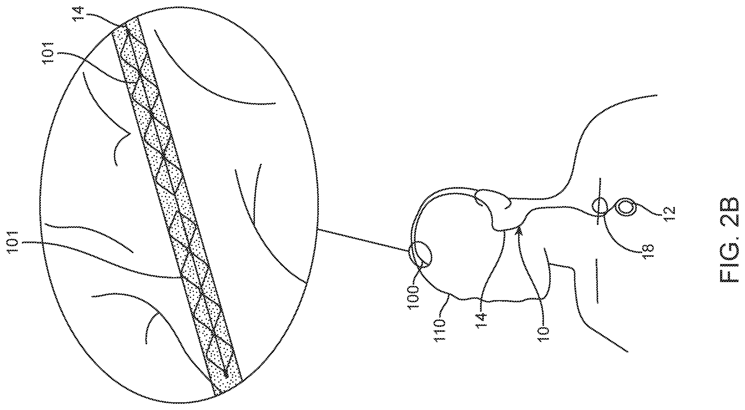 Patent US12396838 Figure 2 – Methods of transmitting neural activity