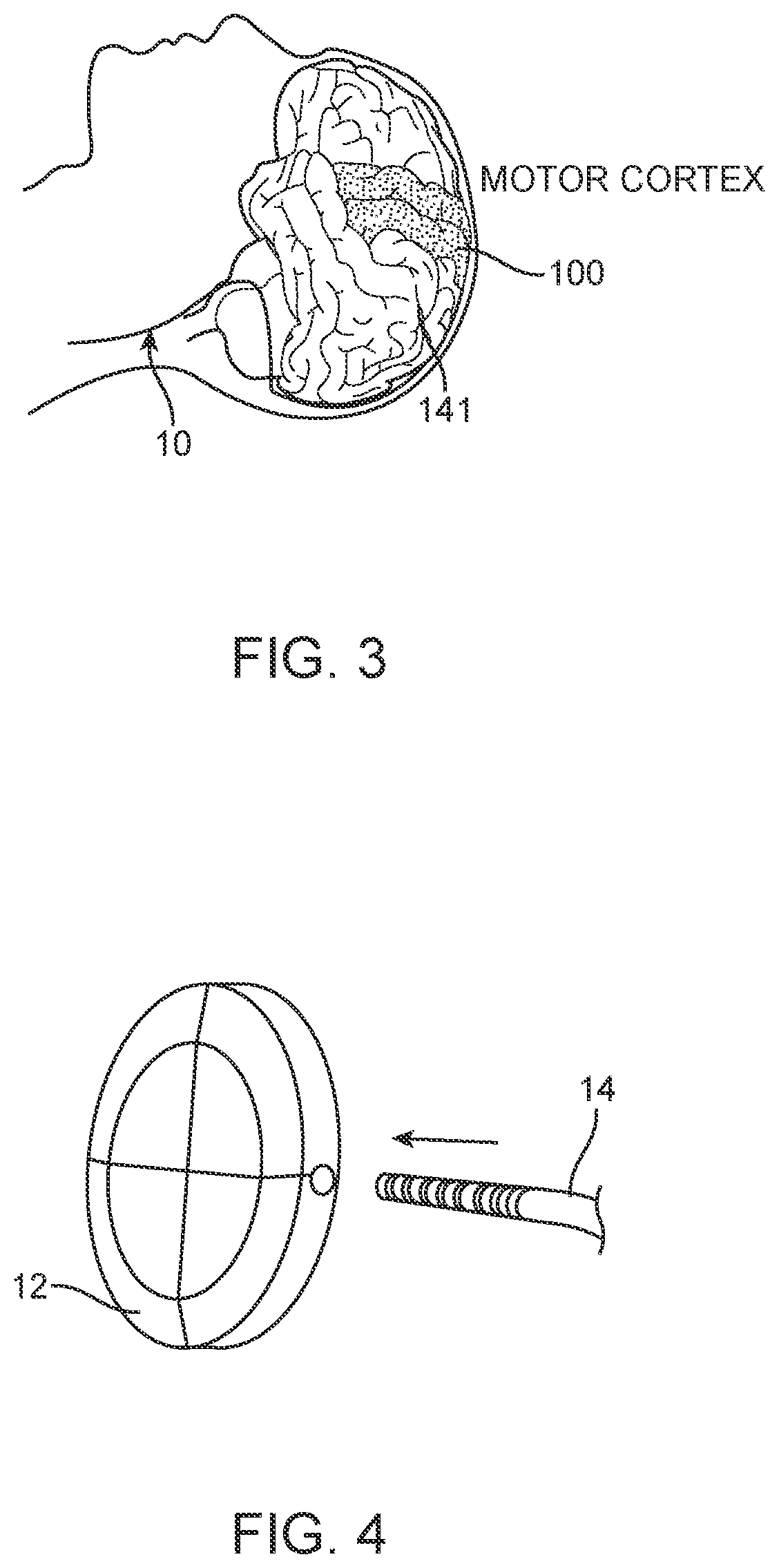 Patent US12396838 Figure 3 – Methods of transmitting neural activity