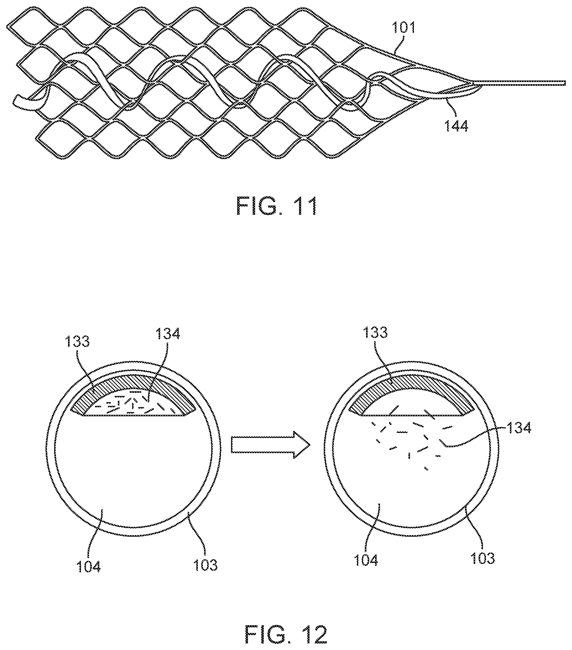 Patent US12396838 Figure 11 – Methods of transmitting neural activity