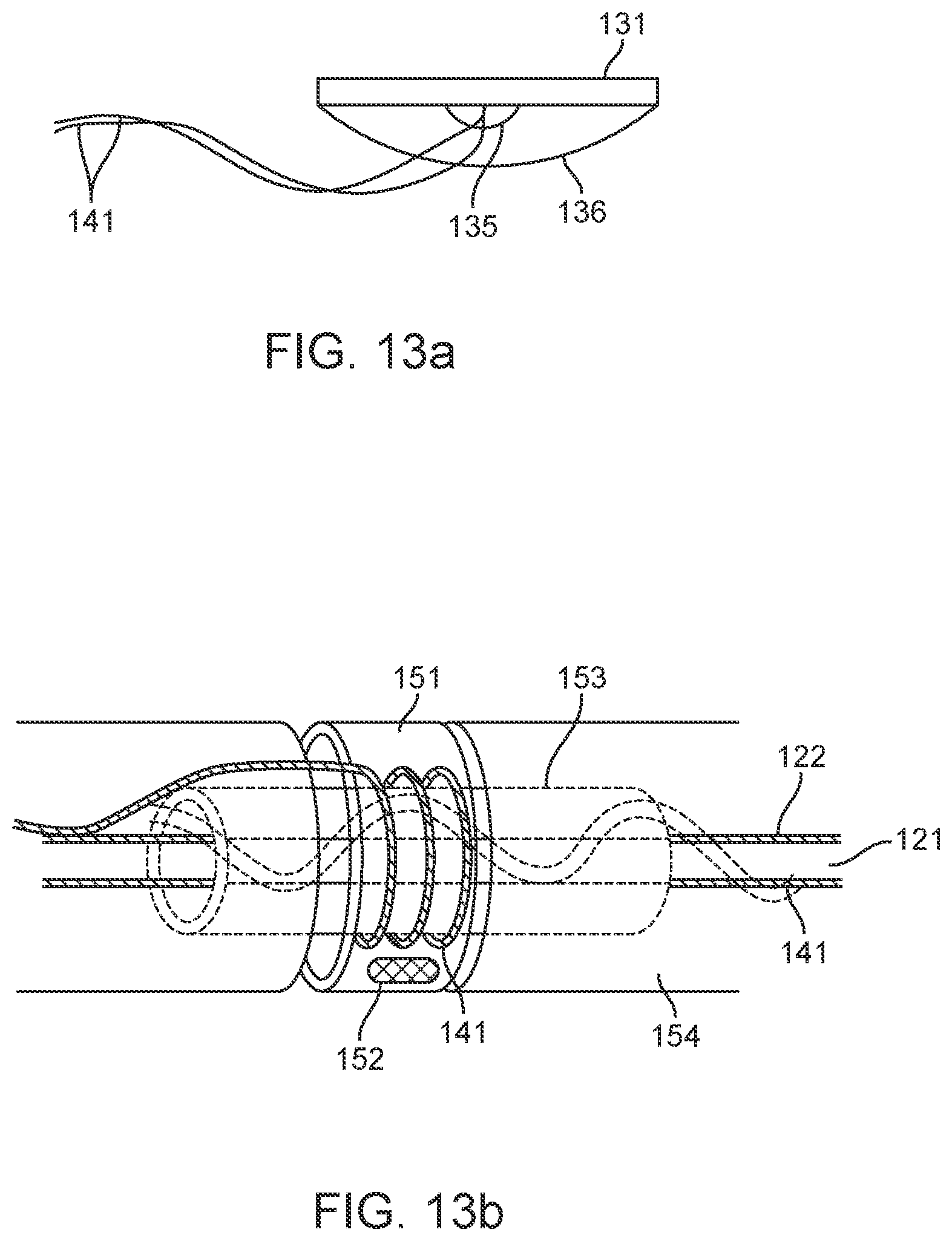 Patent US12396838 Figure 12 – Methods of transmitting neural activity
