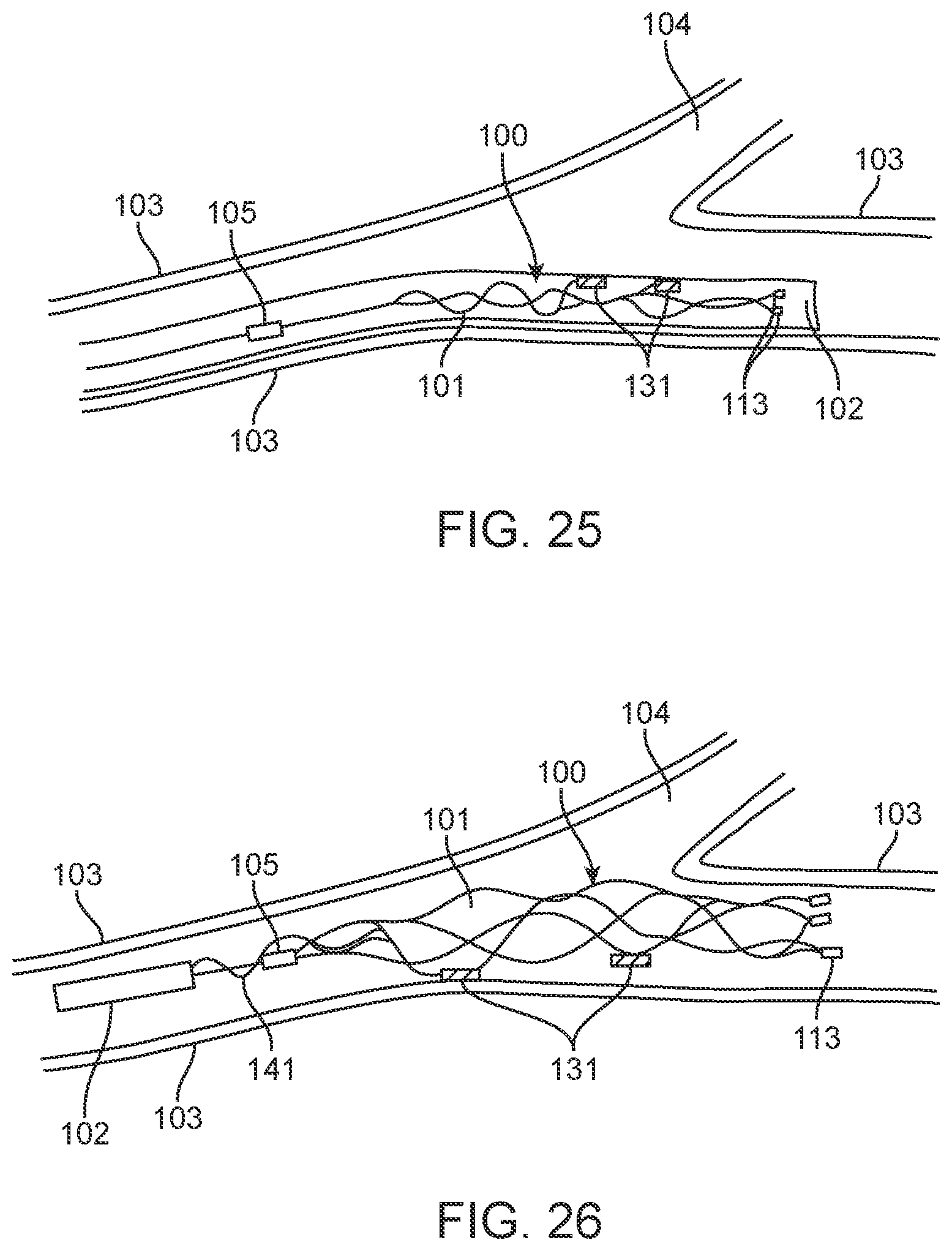 Patent US12396838 Figure 19 – Methods of transmitting neural activity
