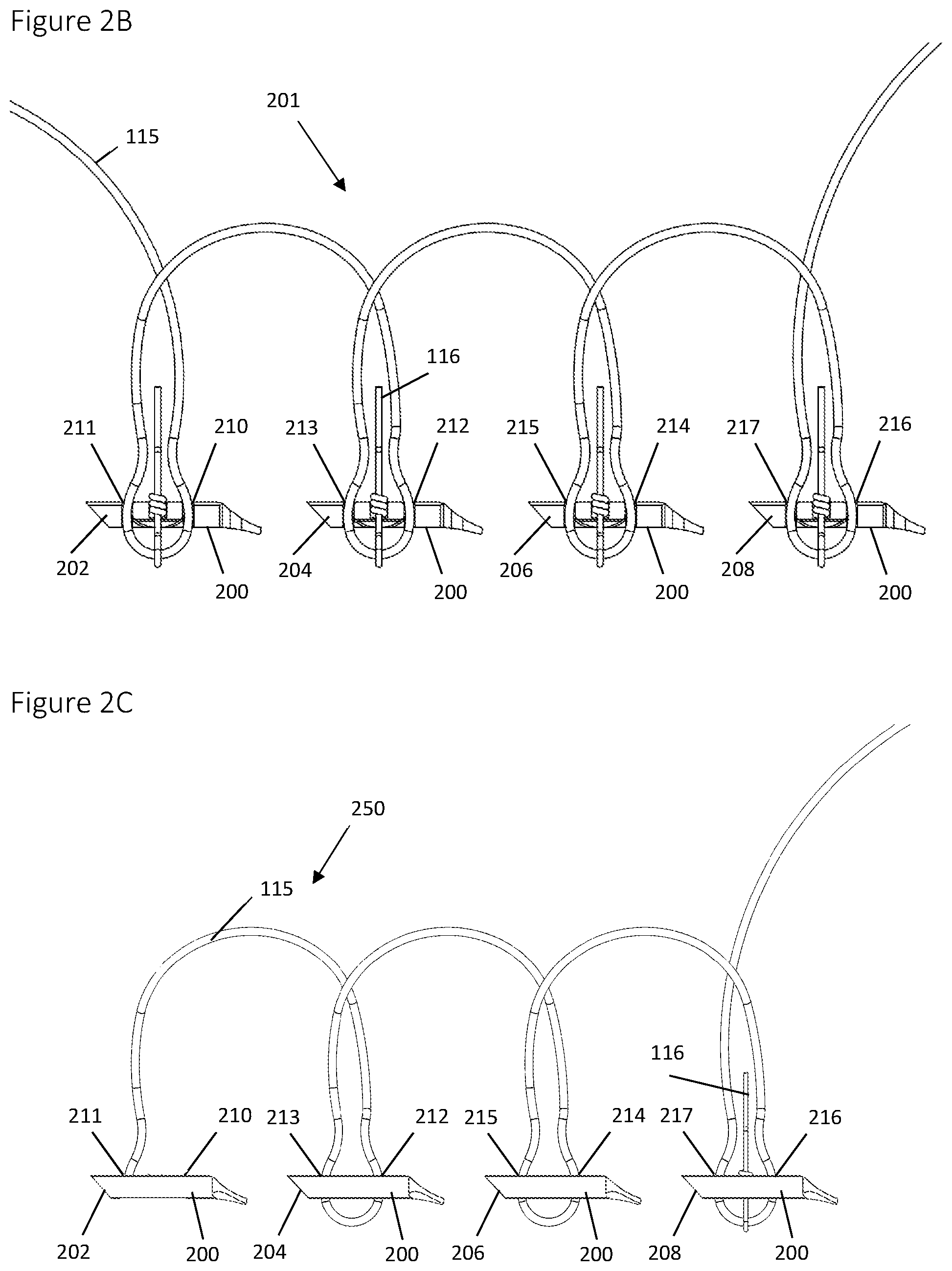 Patent US12396839 Figure 2 – Method and apparatus for creating a seam-like anatomical low creep attachment of soft tissue to bone