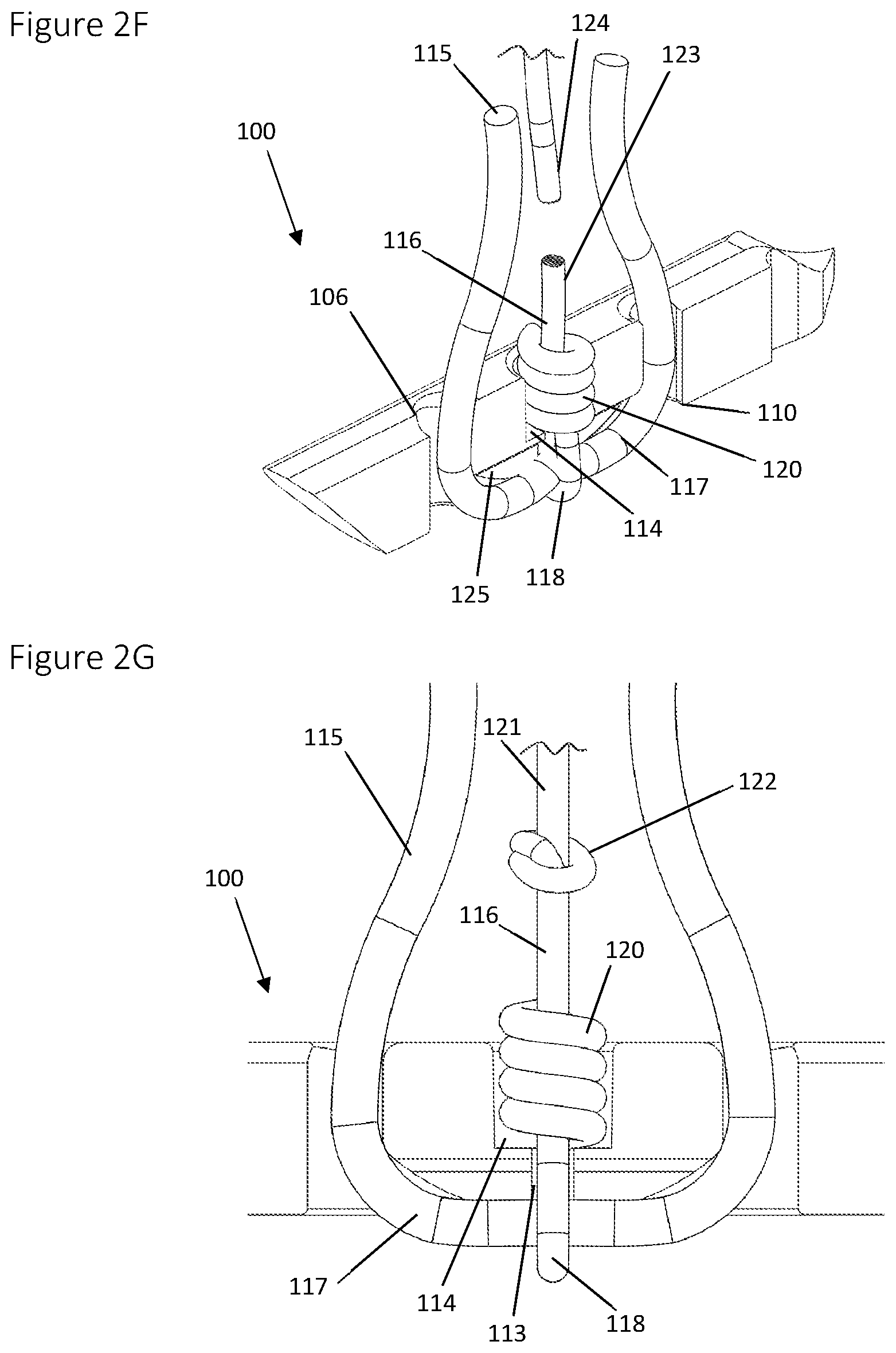 Patent US12396839 Figure 4 – Method and apparatus for creating a seam-like anatomical low creep attachment of soft tissue to bone