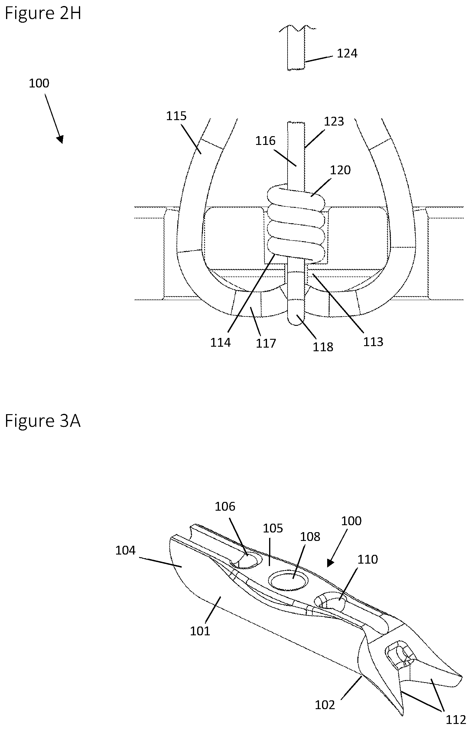 Patent US12396839 Figure 5 – Method and apparatus for creating a seam-like anatomical low creep attachment of soft tissue to bone