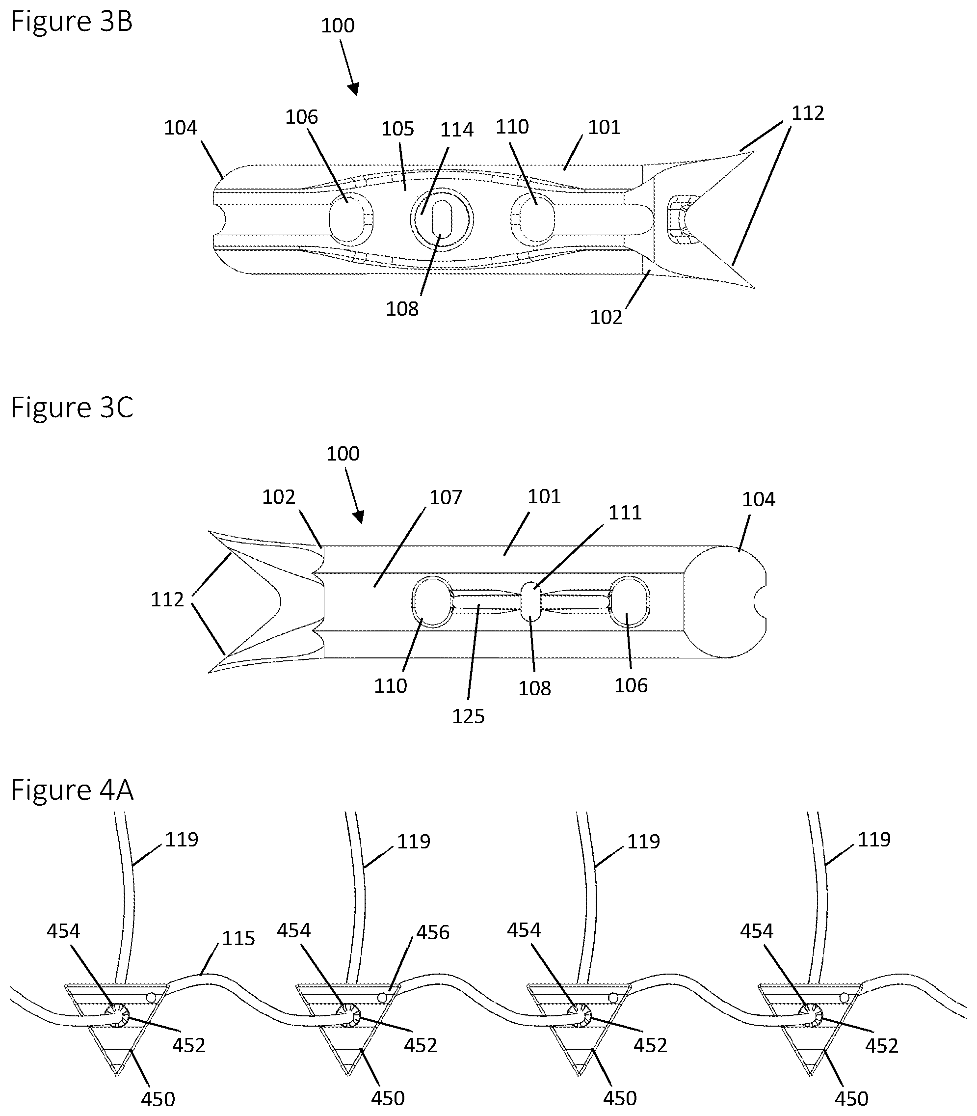 Patent US12396839 Figure 6 – Method and apparatus for creating a seam-like anatomical low creep attachment of soft tissue to bone