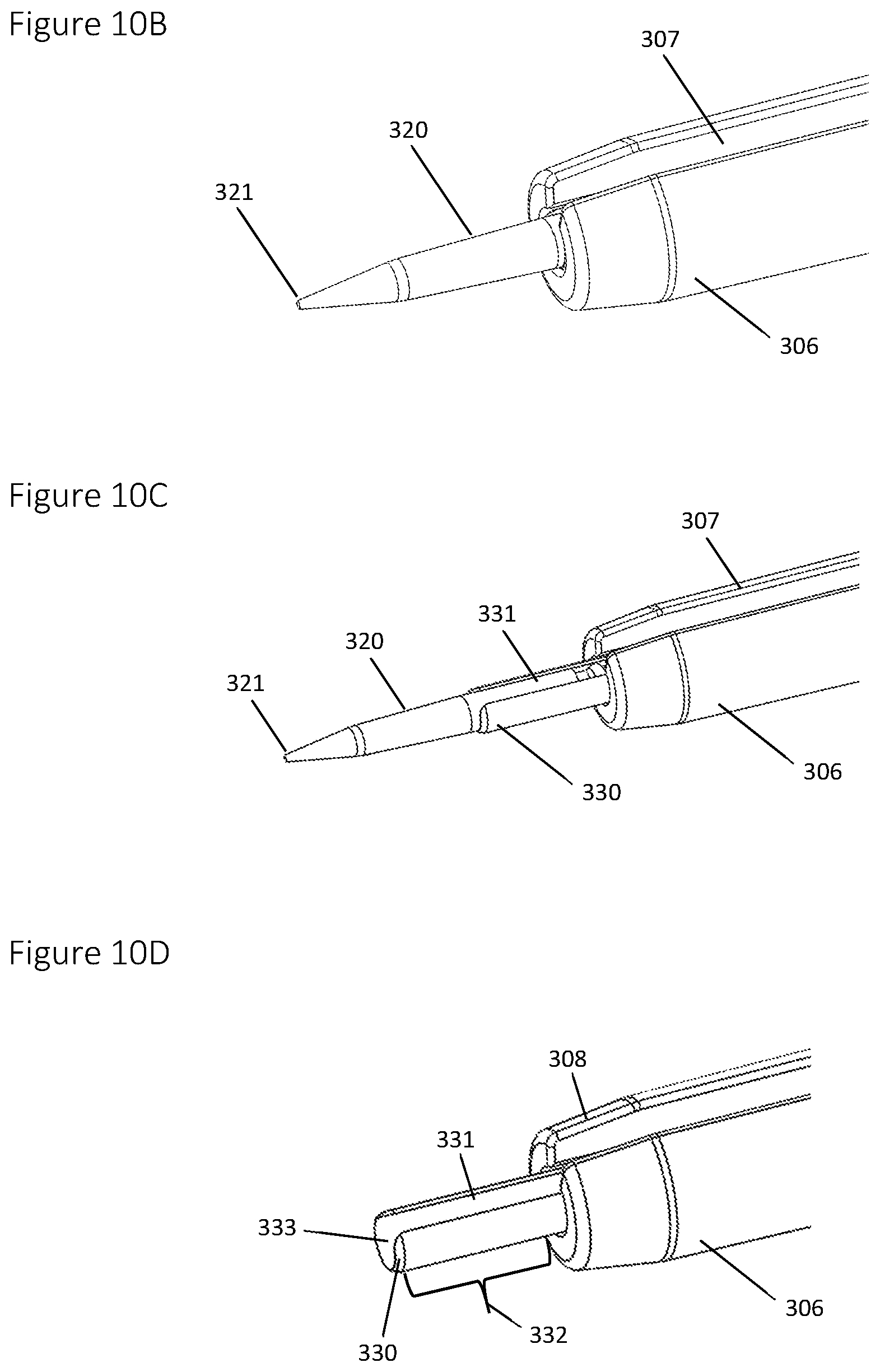 Patent US12396839 Figure 13 – Method and apparatus for creating a seam-like anatomical low creep attachment of soft tissue to bone