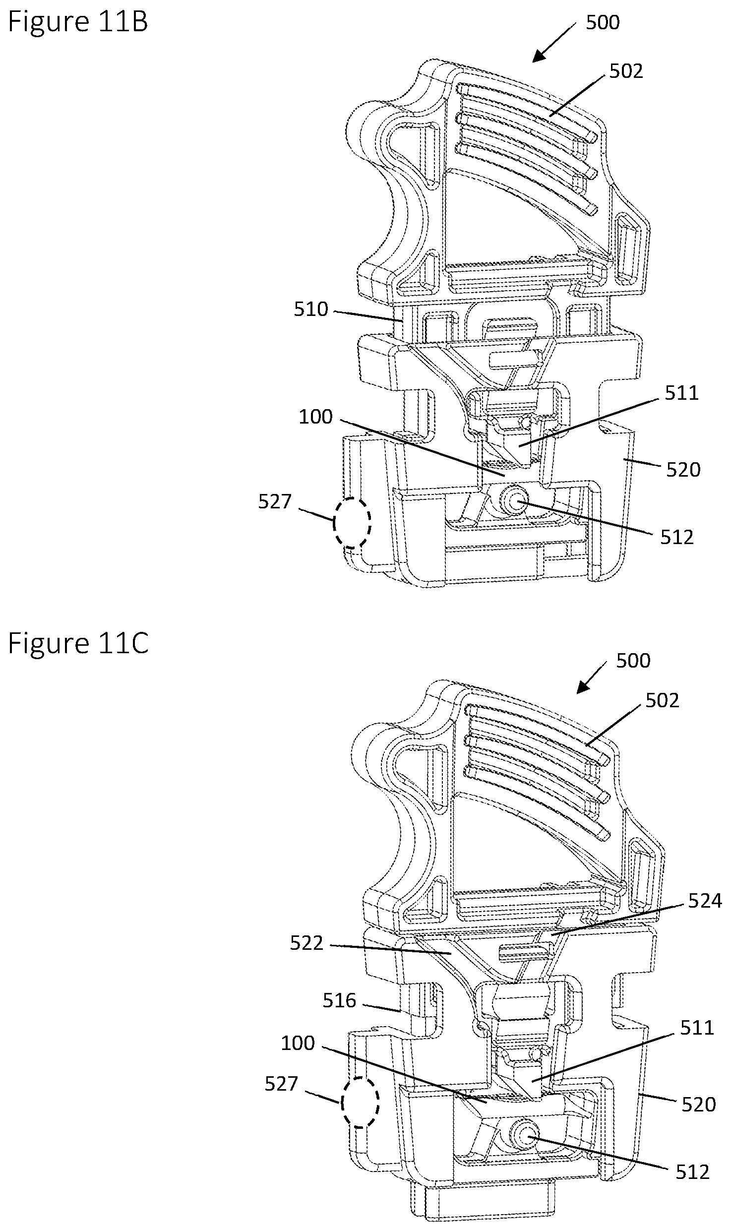 Patent US12396839 Figure 15 – Method and apparatus for creating a seam-like anatomical low creep attachment of soft tissue to bone