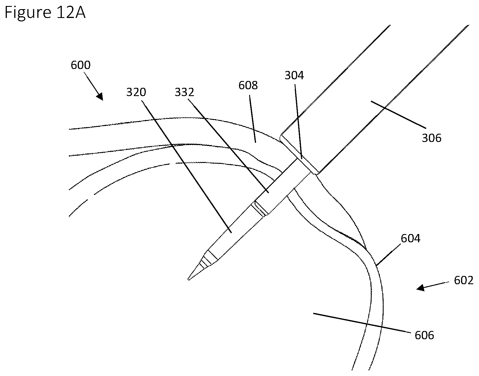 Patent US12396839 Figure 17 – Method and apparatus for creating a seam-like anatomical low creep attachment of soft tissue to bone