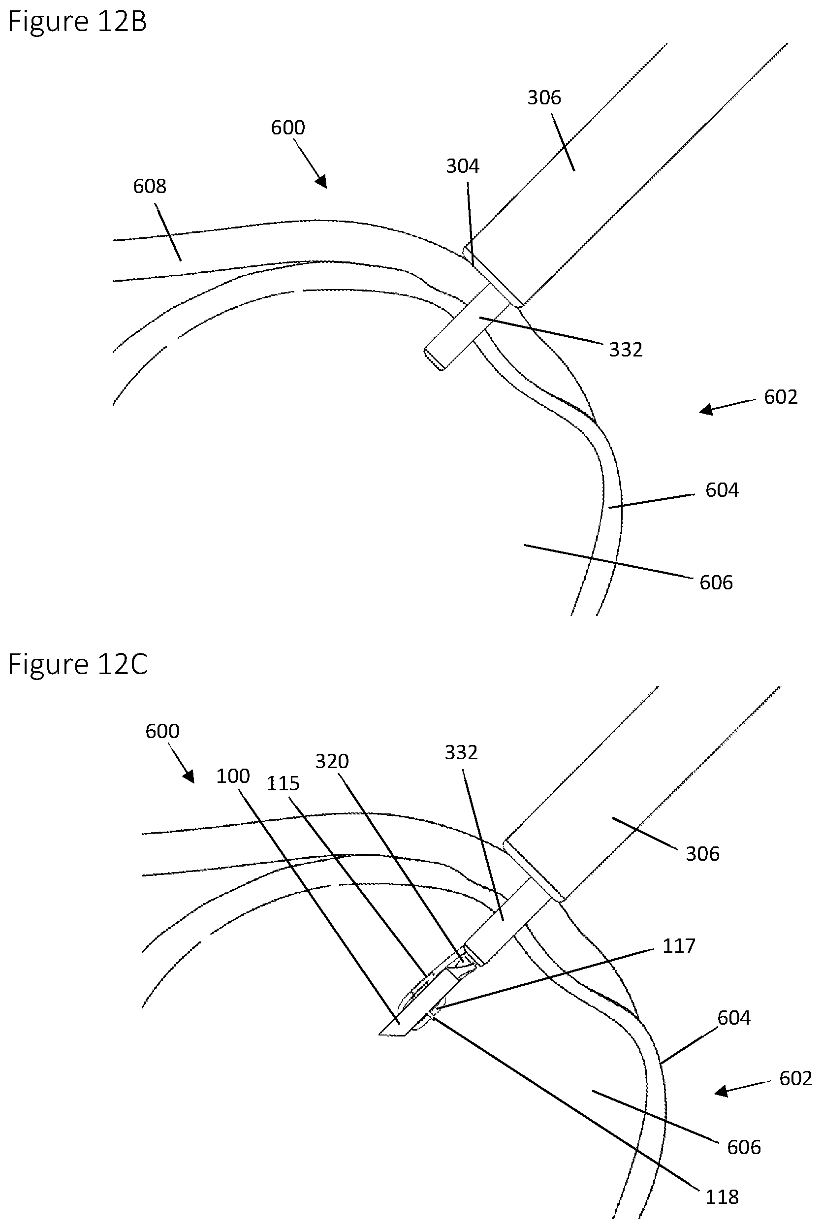 Patent US12396839 Figure 18 – Method and apparatus for creating a seam-like anatomical low creep attachment of soft tissue to bone