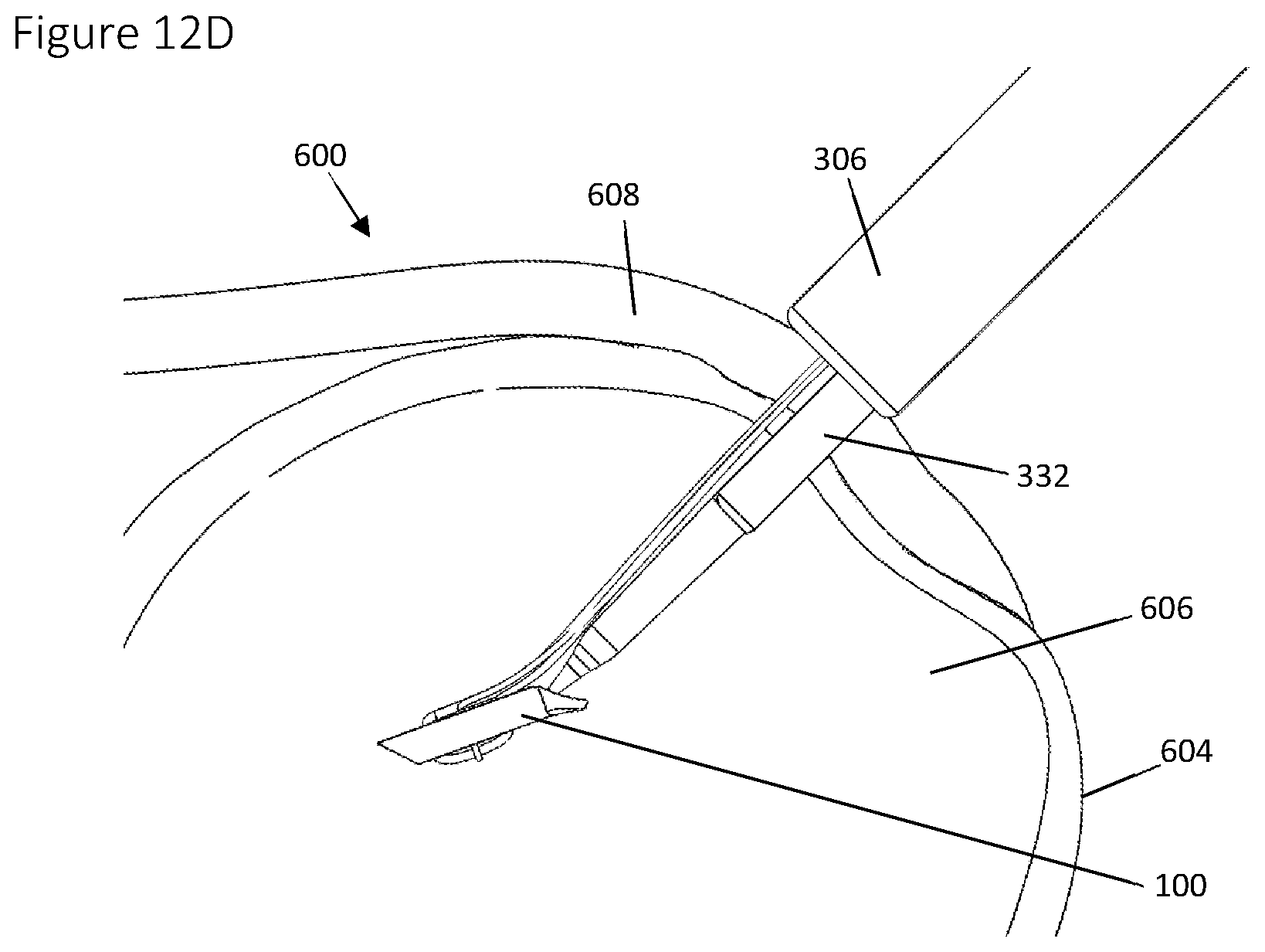 Patent US12396839 Figure 19 – Method and apparatus for creating a seam-like anatomical low creep attachment of soft tissue to bone