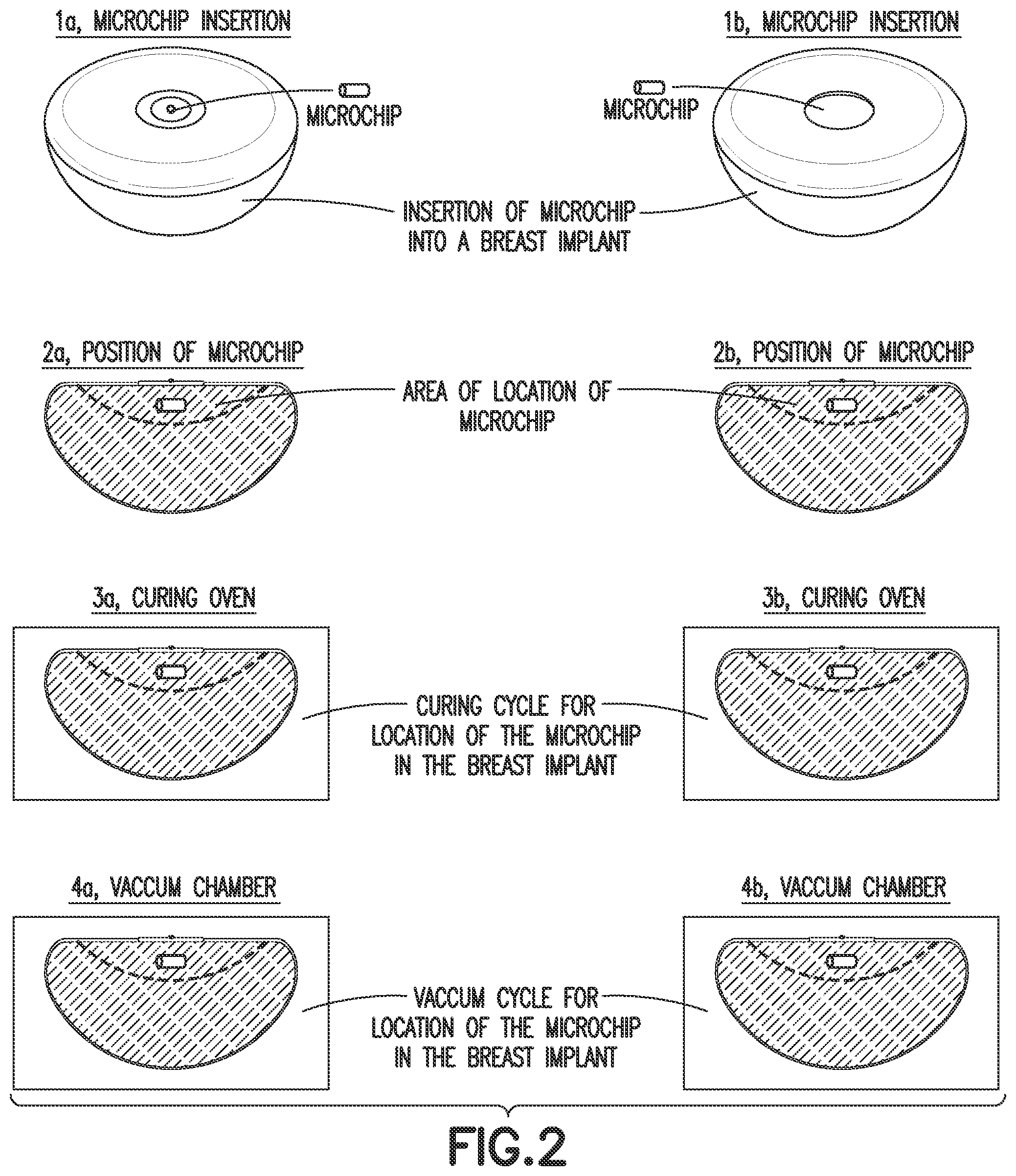 Patent US12396840 Figure 2 – Breast implants with integrated transponders