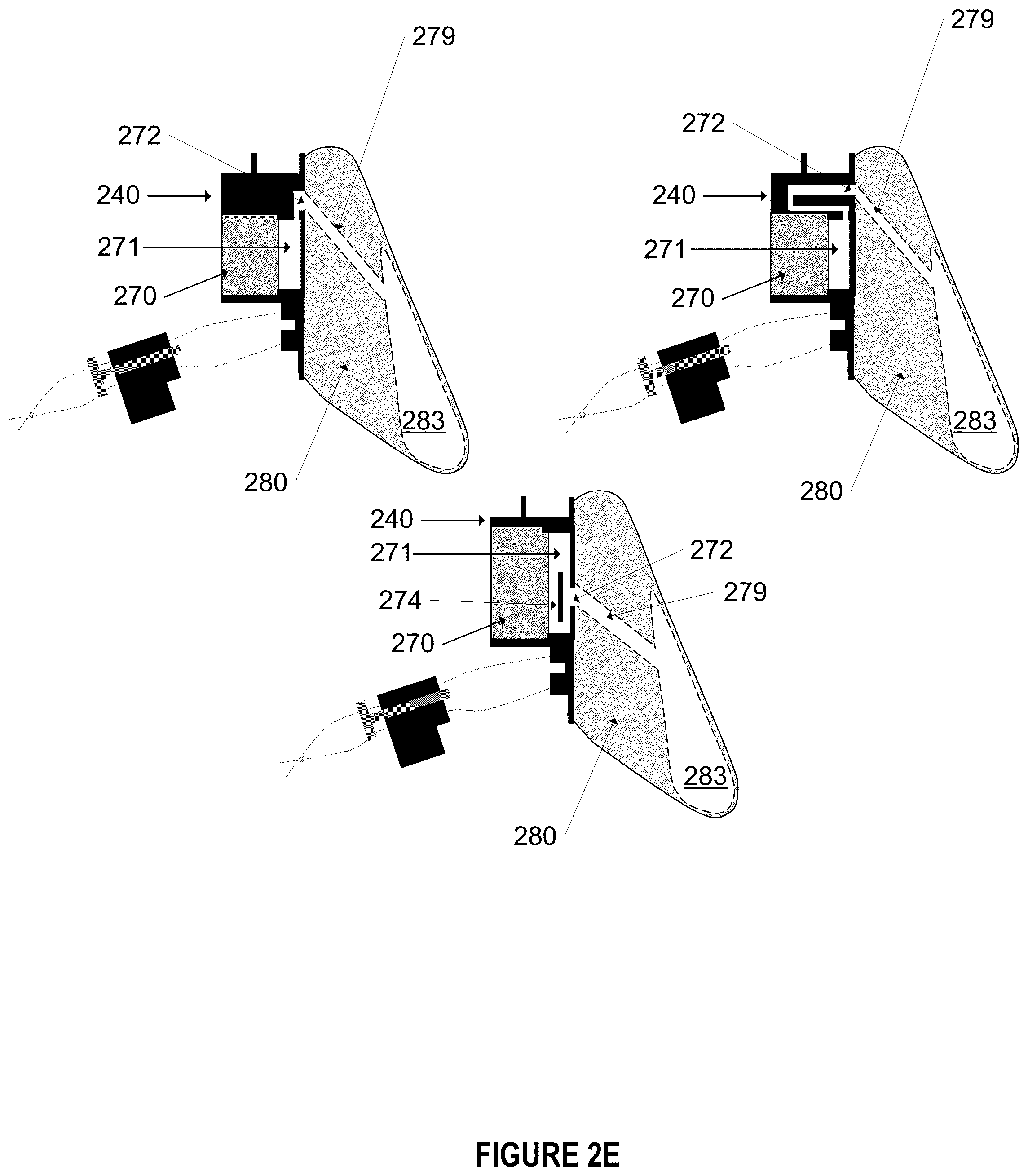 Patent US12396844 Figure 8 – Methods and apparatus for treating glottic insufficiency