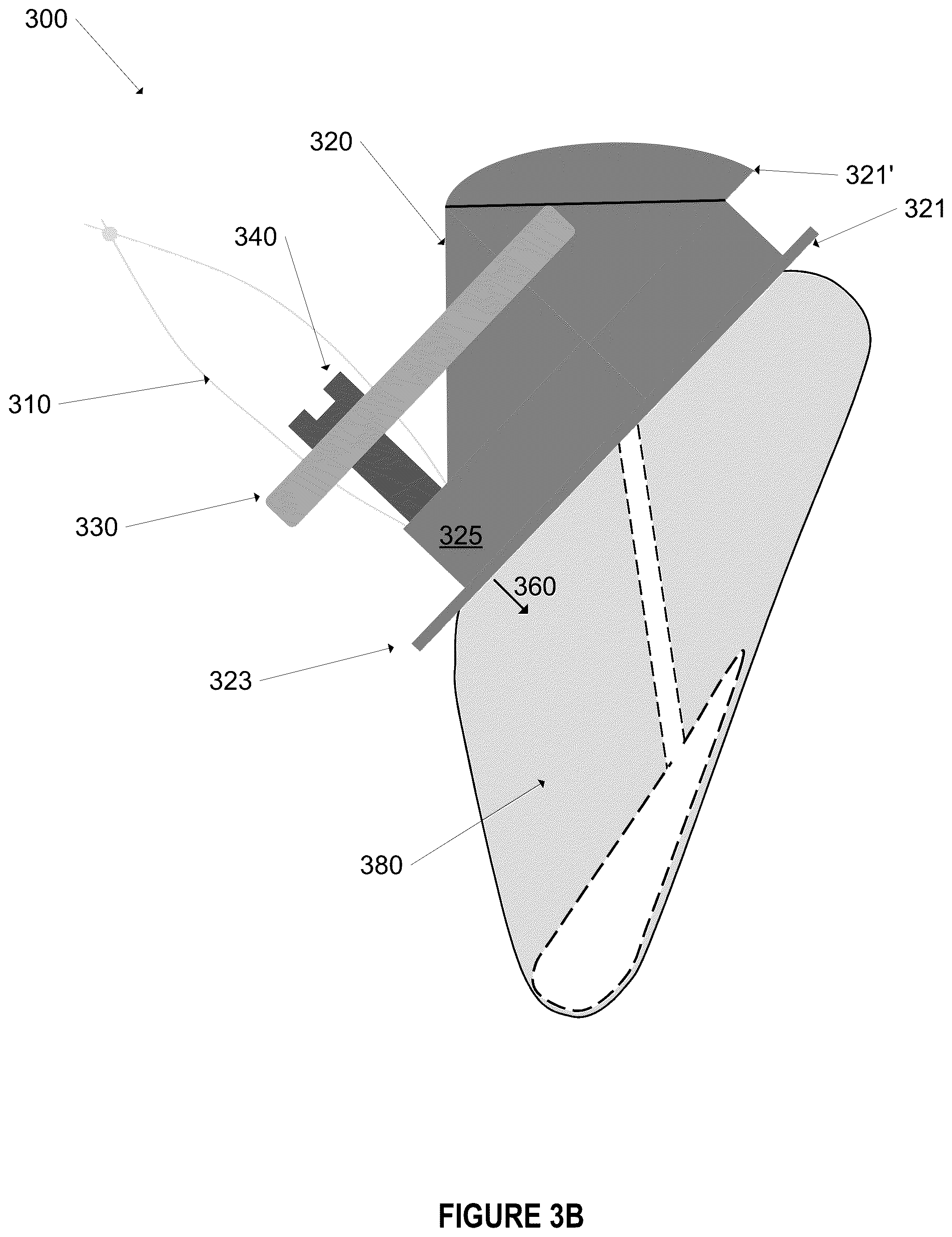 Patent US12396844 Figure 10 – Methods and apparatus for treating glottic insufficiency