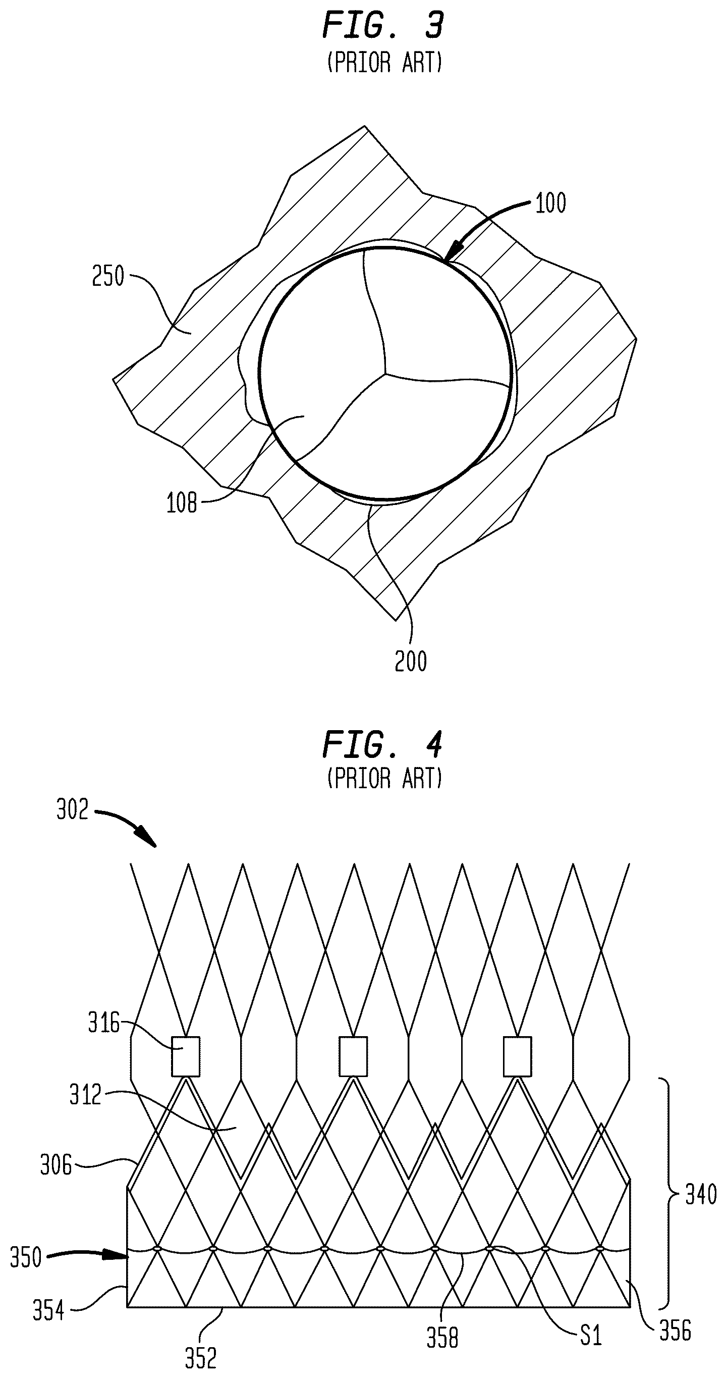 Patent US12396845 Figure 3 – Fabric material for medical devices