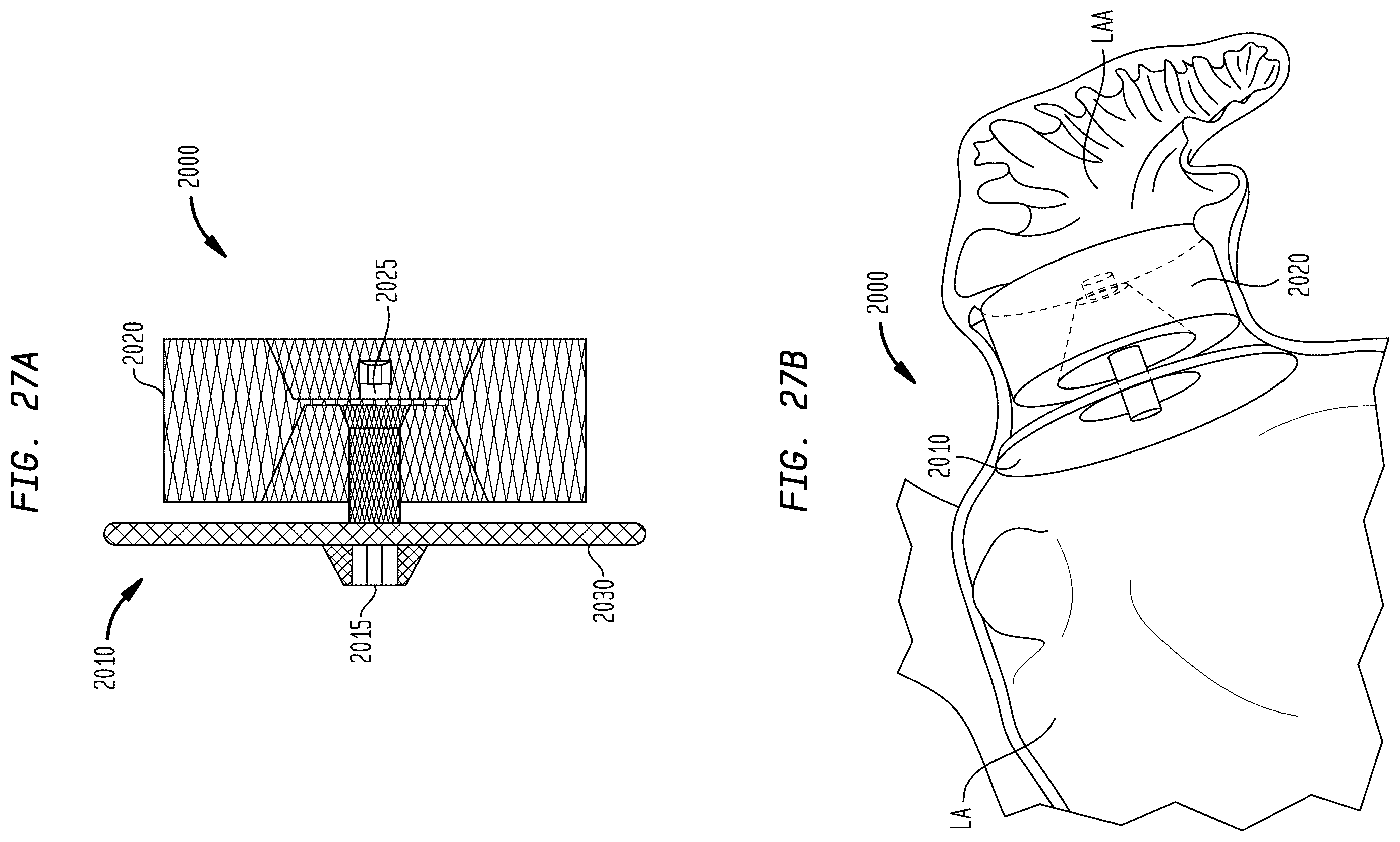 Patent US12396845 Figure 17 – Fabric material for medical devices