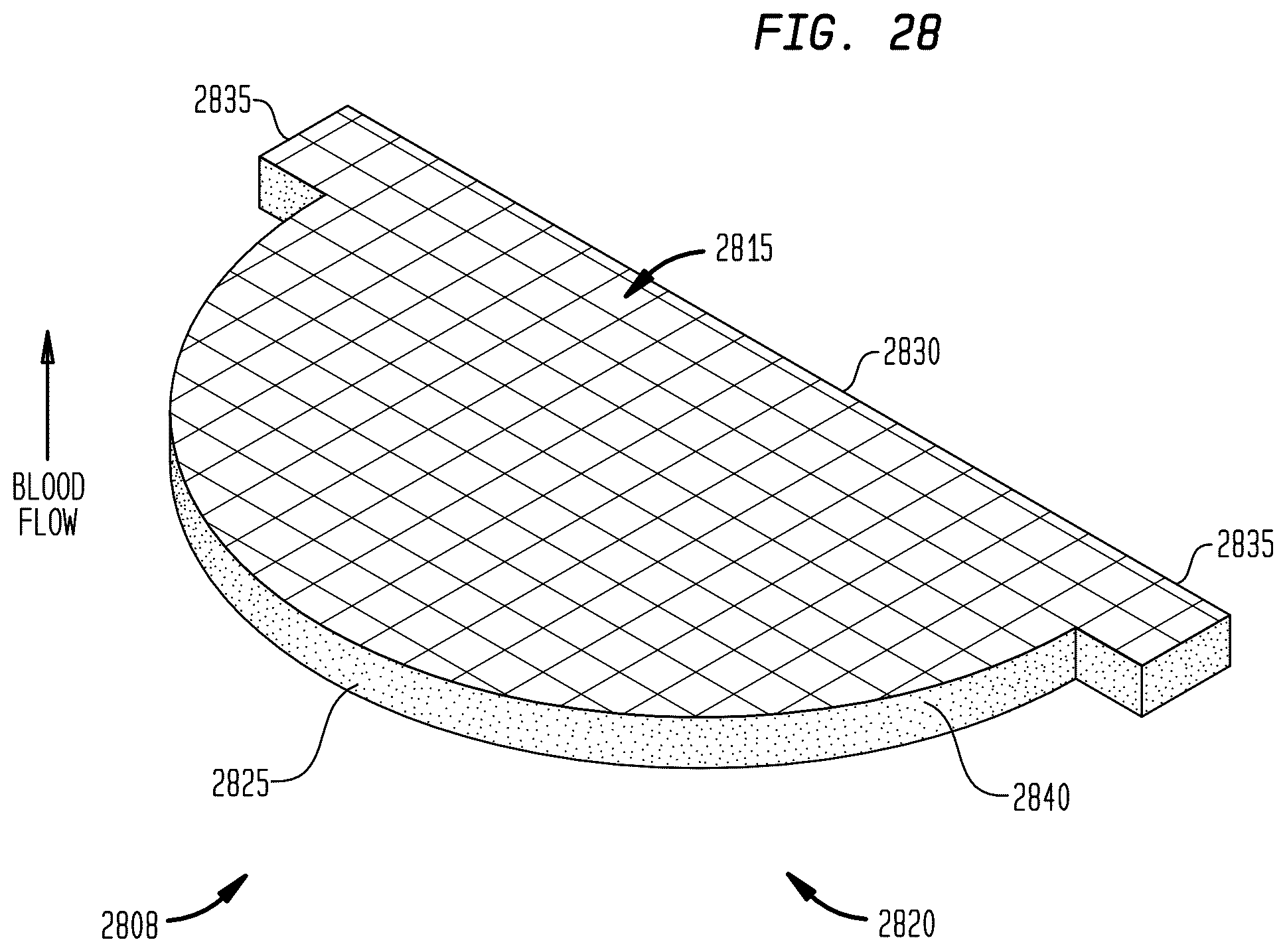 Patent US12396845 Figure 18 – Fabric material for medical devices