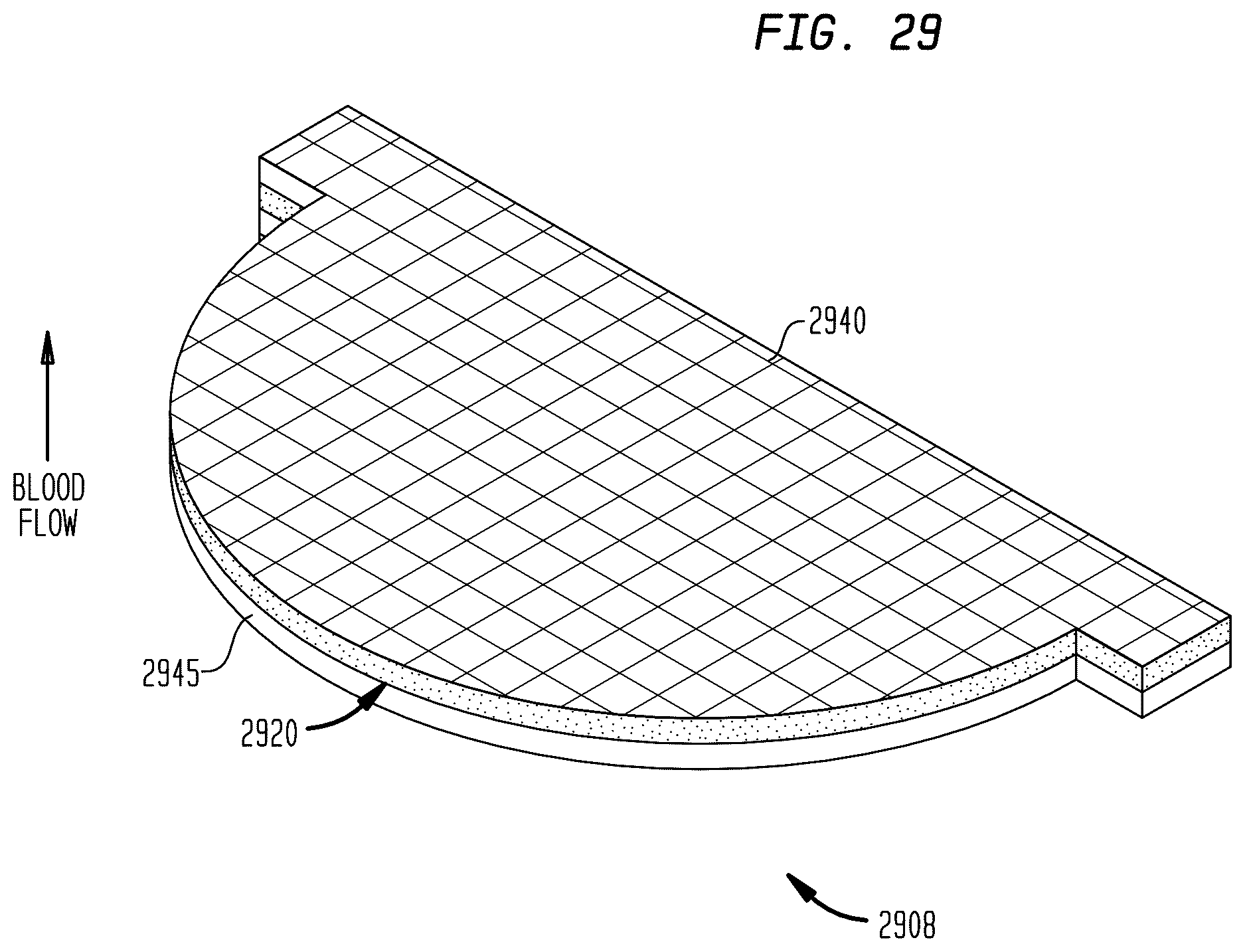 Patent US12396845 Figure 19 – Fabric material for medical devices