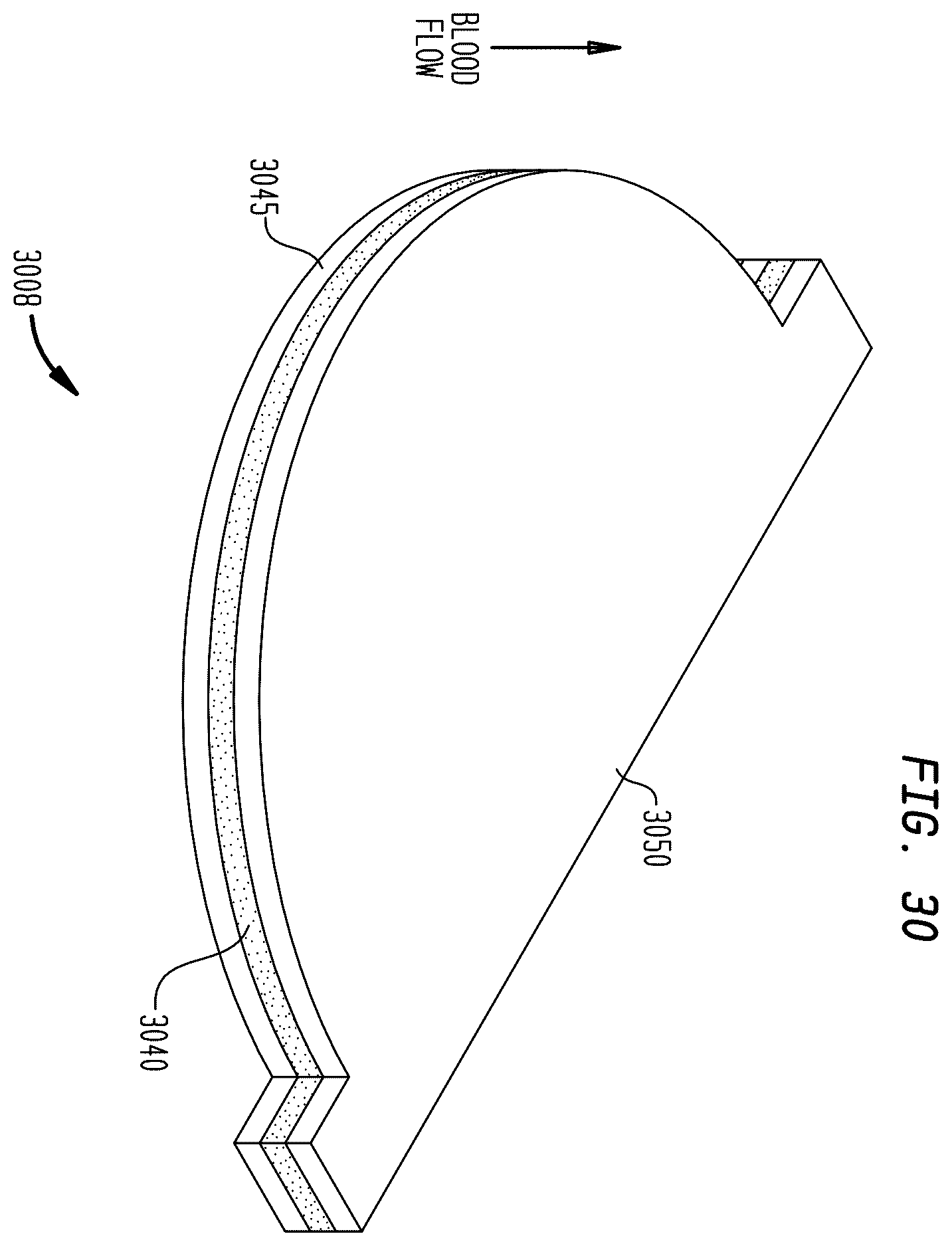 Patent US12396845 Figure 20 – Fabric material for medical devices