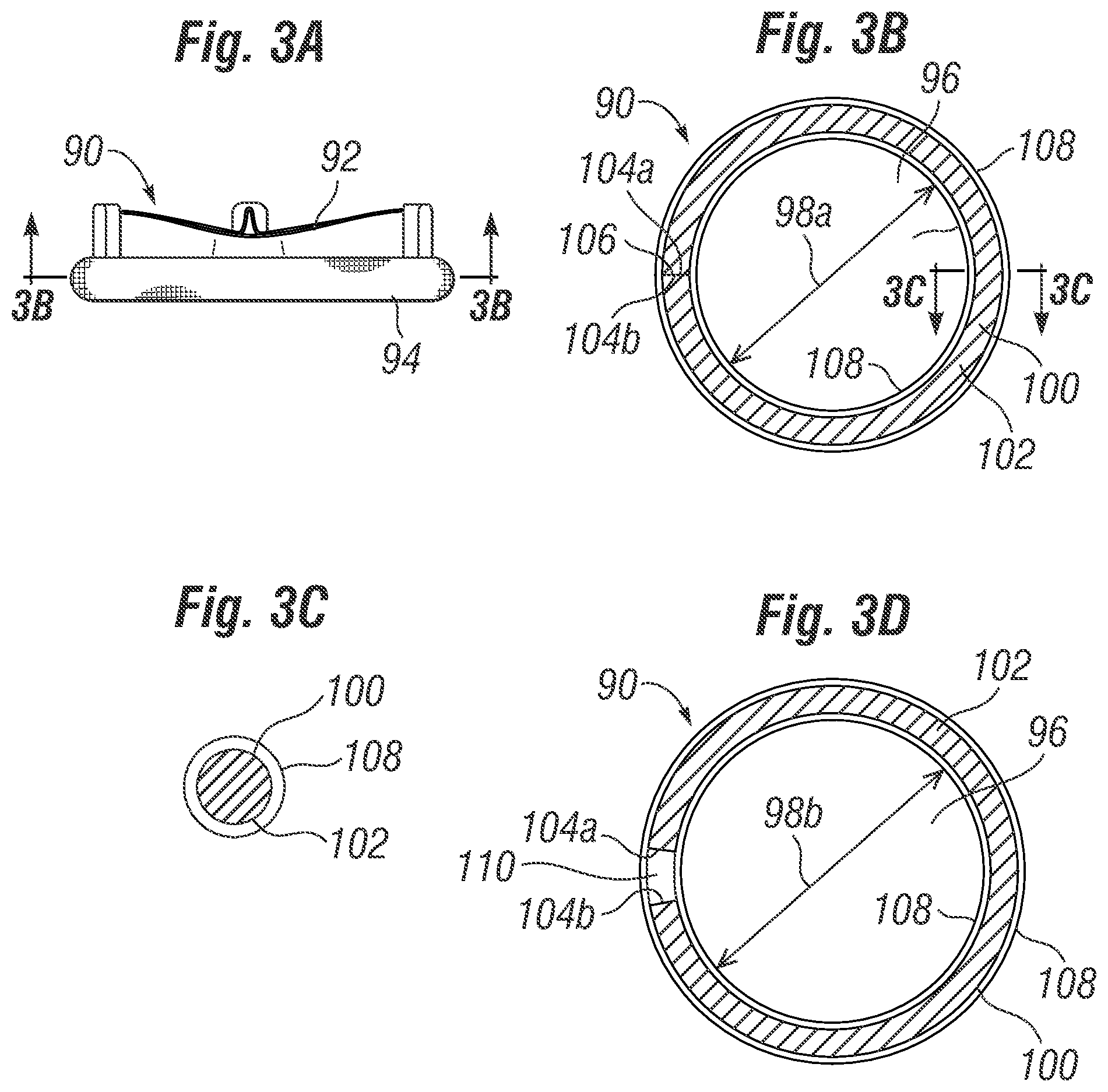 Patent US12396846 Figure 3 – Methods of implanting a prosthetic heart valve within another
