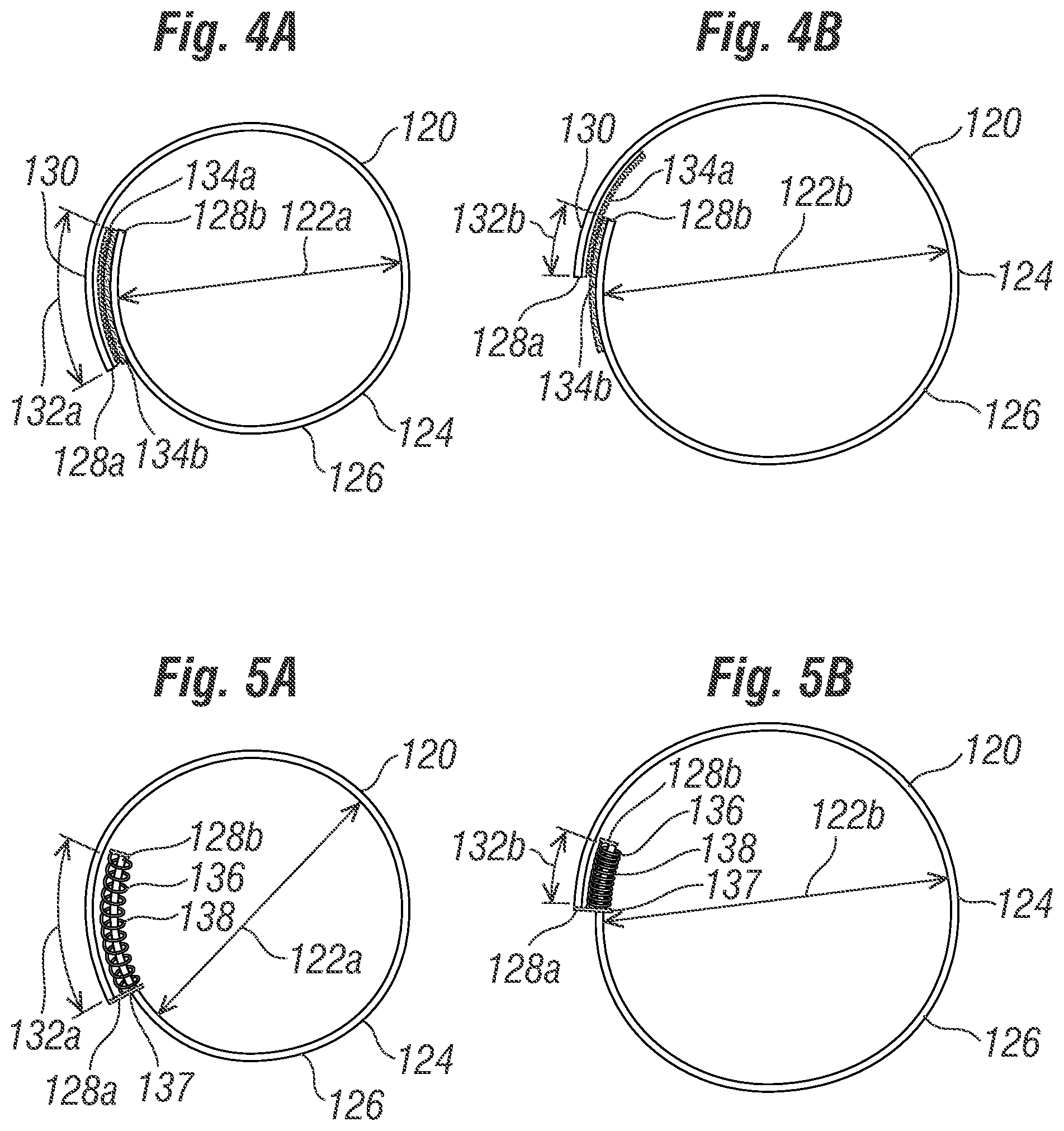 Patent US12396846 Figure 4 – Methods of implanting a prosthetic heart valve within another