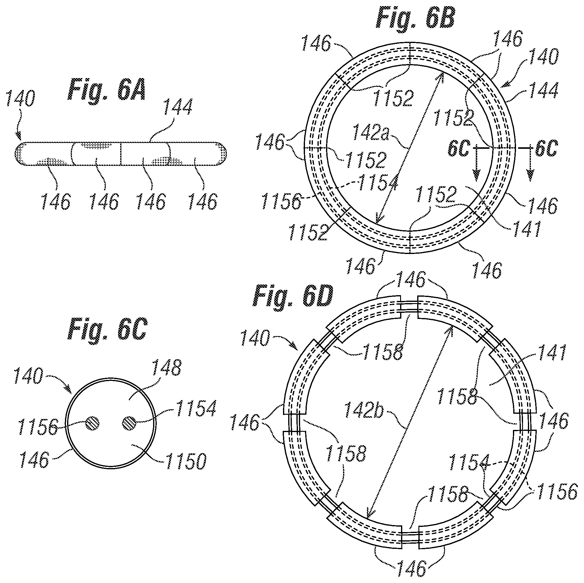 Patent US12396846 Figure 5 – Methods of implanting a prosthetic heart valve within another