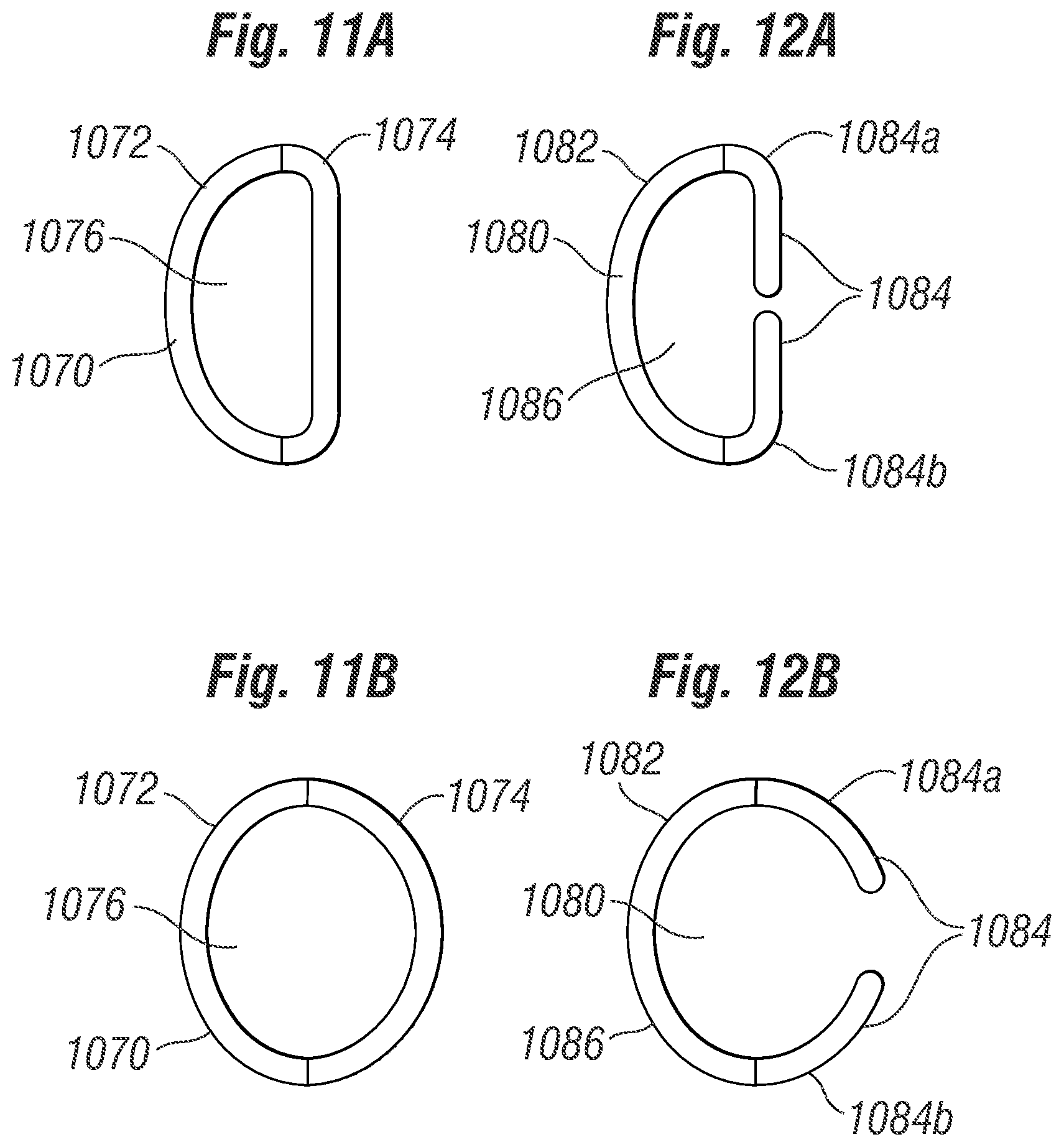 Patent US12396846 Figure 11 – Methods of implanting a prosthetic heart valve within another