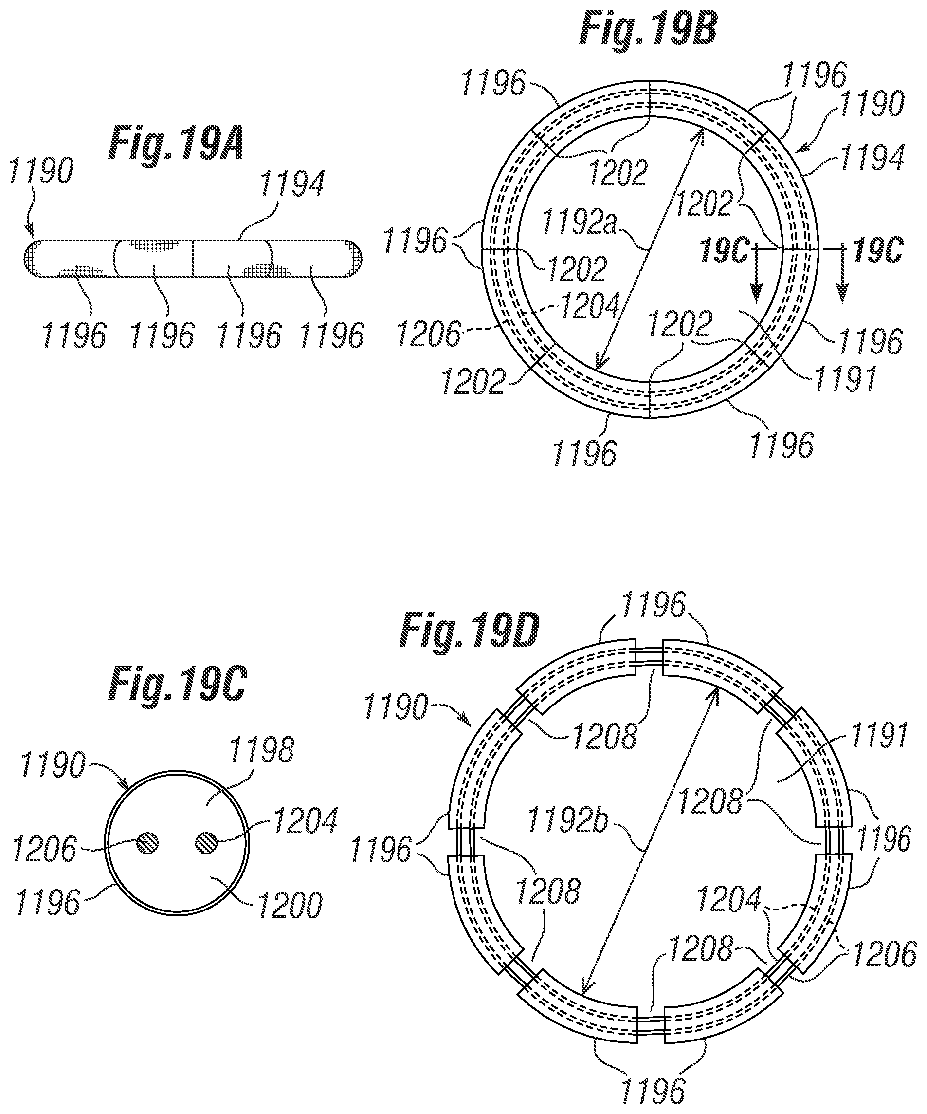 Patent US12396846 Figure 18 – Methods of implanting a prosthetic heart valve within another